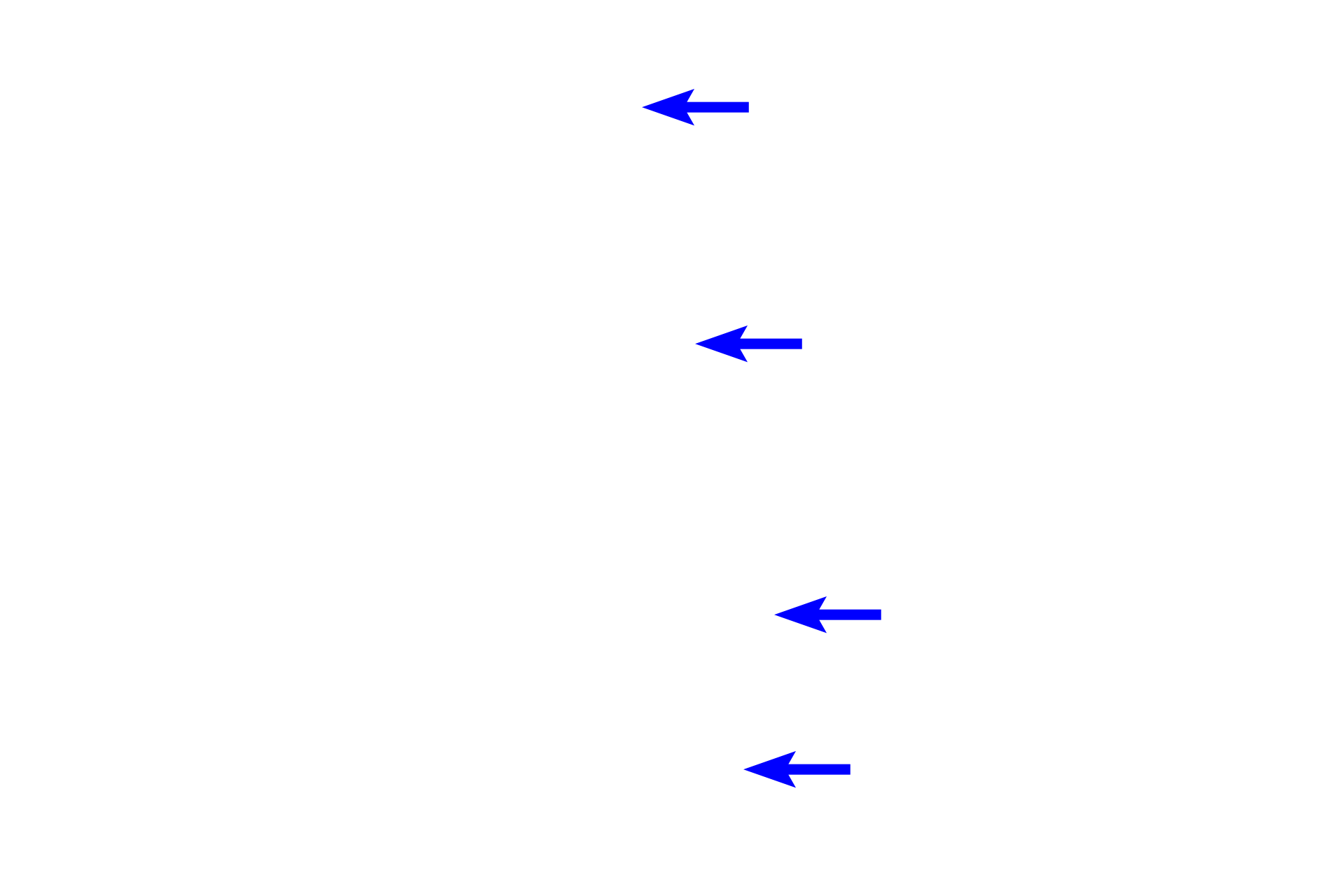 Dentin <p>Because of its high calcium content, little visible enamel remains in a decalcified tooth preparation such as this.  The approximate location of the enamel is shown in blue.  Dentin comprises the bulk of the tooth and is formed throughout life.  Cementum, a thin layer surrounding the dentin of the tooth root, is also formed throughout life; a thickening reflecting the continued growth of this layer is seen on the apex of the left root.</p>
