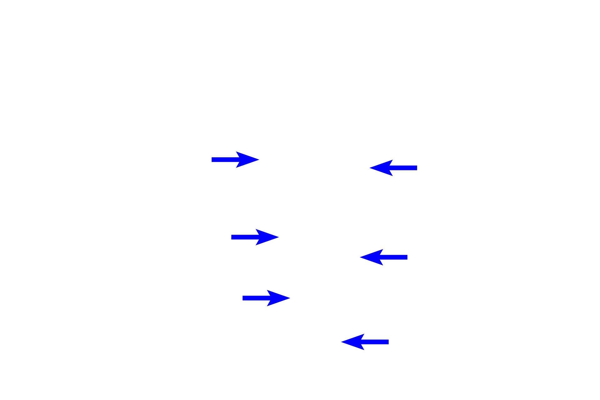 Cementum <p>Because of its high calcium content, little visible enamel remains in a decalcified tooth preparation such as this.  The approximate location of the enamel is shown in blue.  Dentin comprises the bulk of the tooth and is formed throughout life.  Cementum, a thin layer surrounding the dentin of the tooth root, is also formed throughout life; a thickening reflecting the continued growth of this layer is seen on the apex of the left root.</p>
