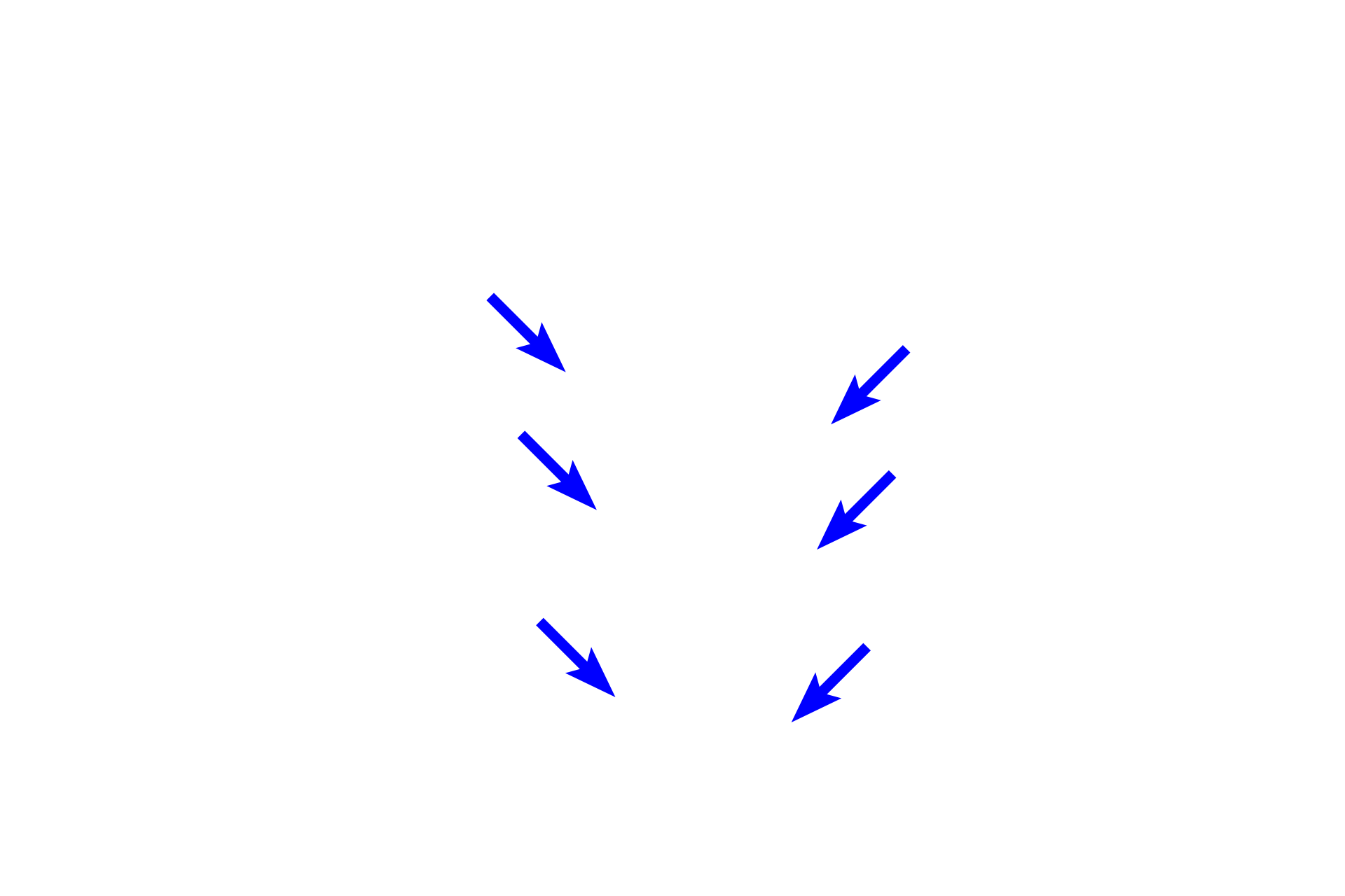 Periodontal ligament > <p>The periodontal ligament extends between the cementum of the tooth and alveolar bone, suspending the tooth between these two hard tissues.  The periodontal ligament cushions the tooth from the forces of mastication.</p>
