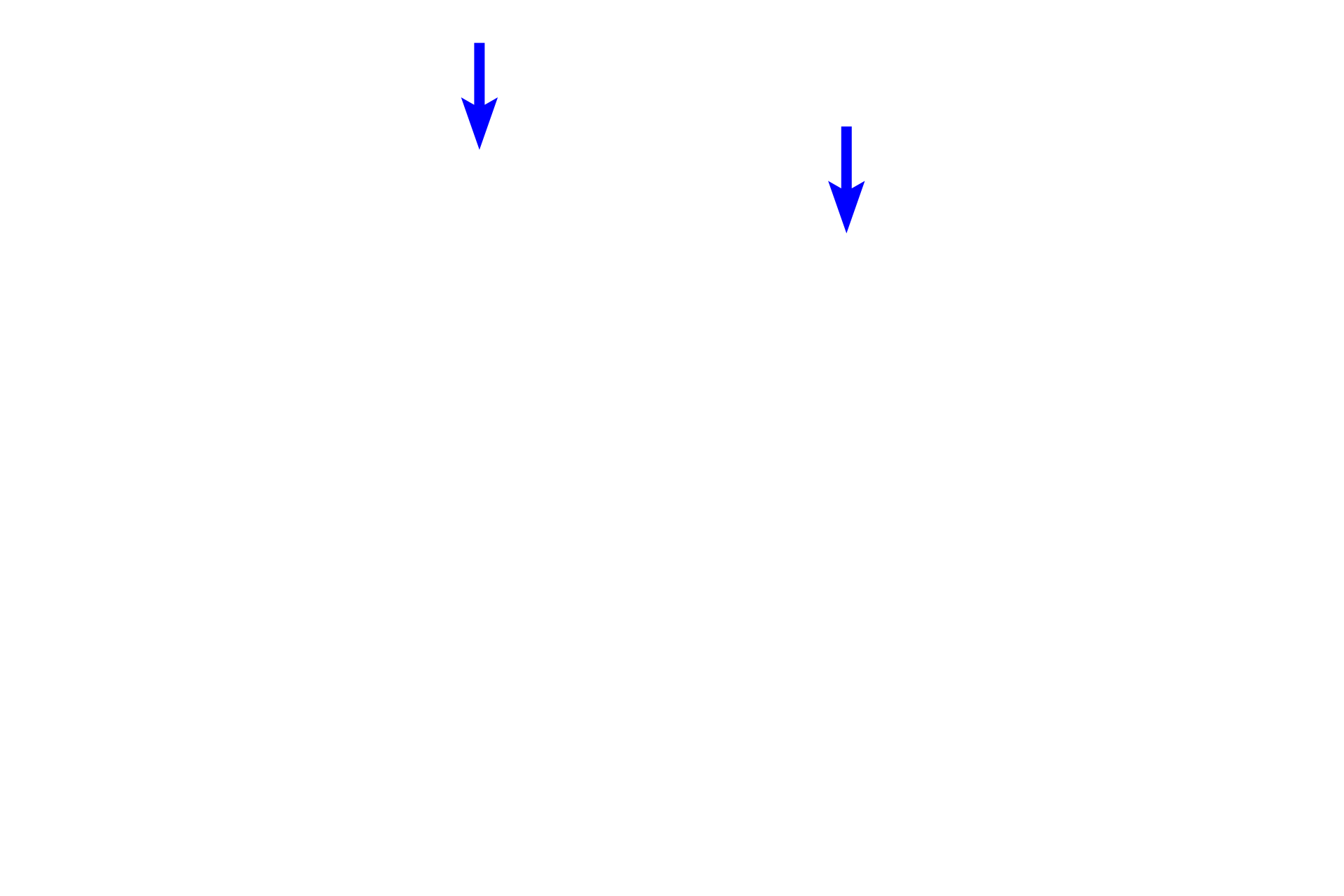 Gingival sulcus > <p>The gingival sulcus is a circular moat located between the enamel of the tooth and the sulcular epithelium of the gingiva.  In life, the sulcular epithelium is closely applied to the enamel.</p>

