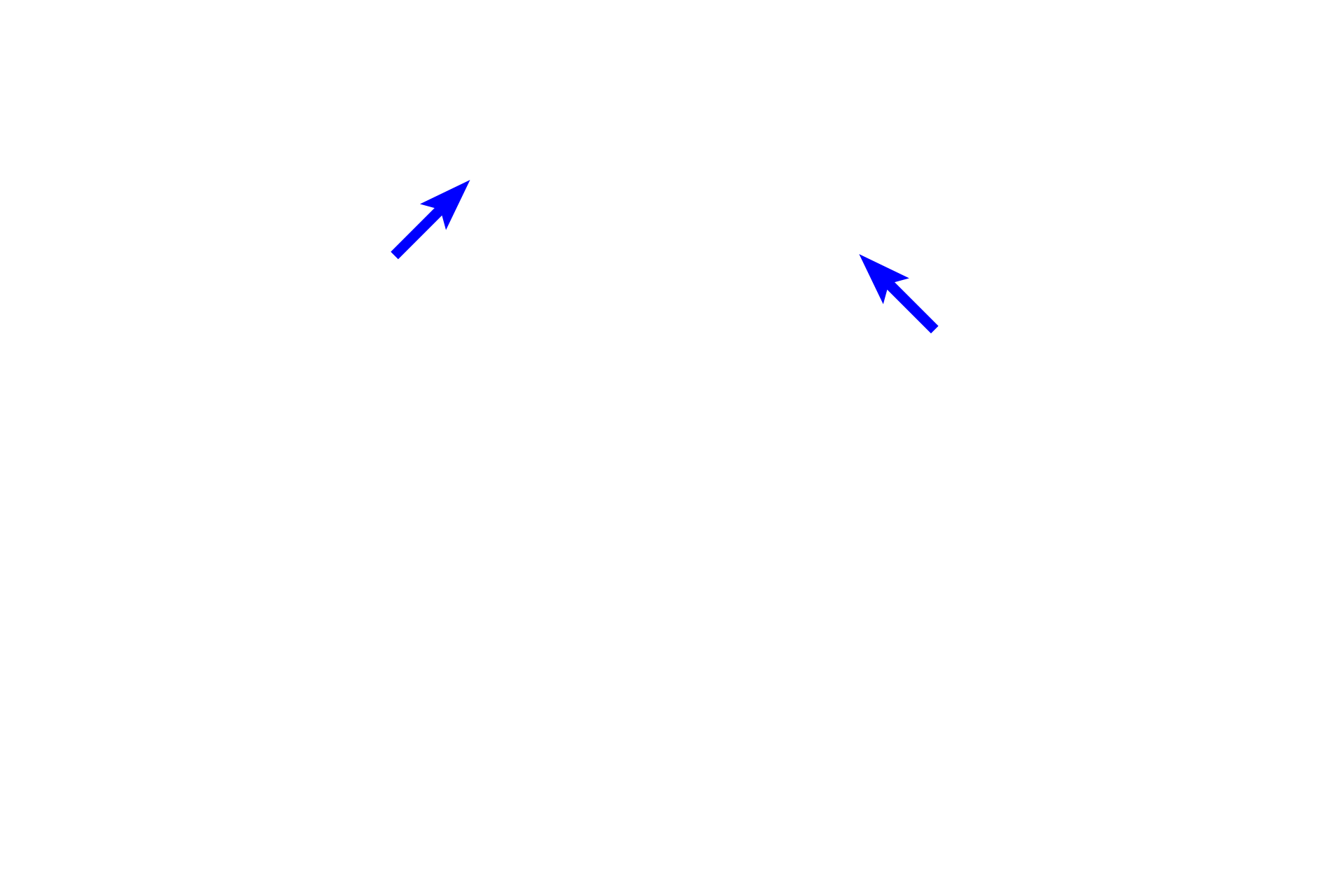 Sulcular epithelium > <p>Sulcular epithelium forms the portion of the gingiva facing the gingival sulcus and is composed of a stratified squamous moist epithelium.</p>
