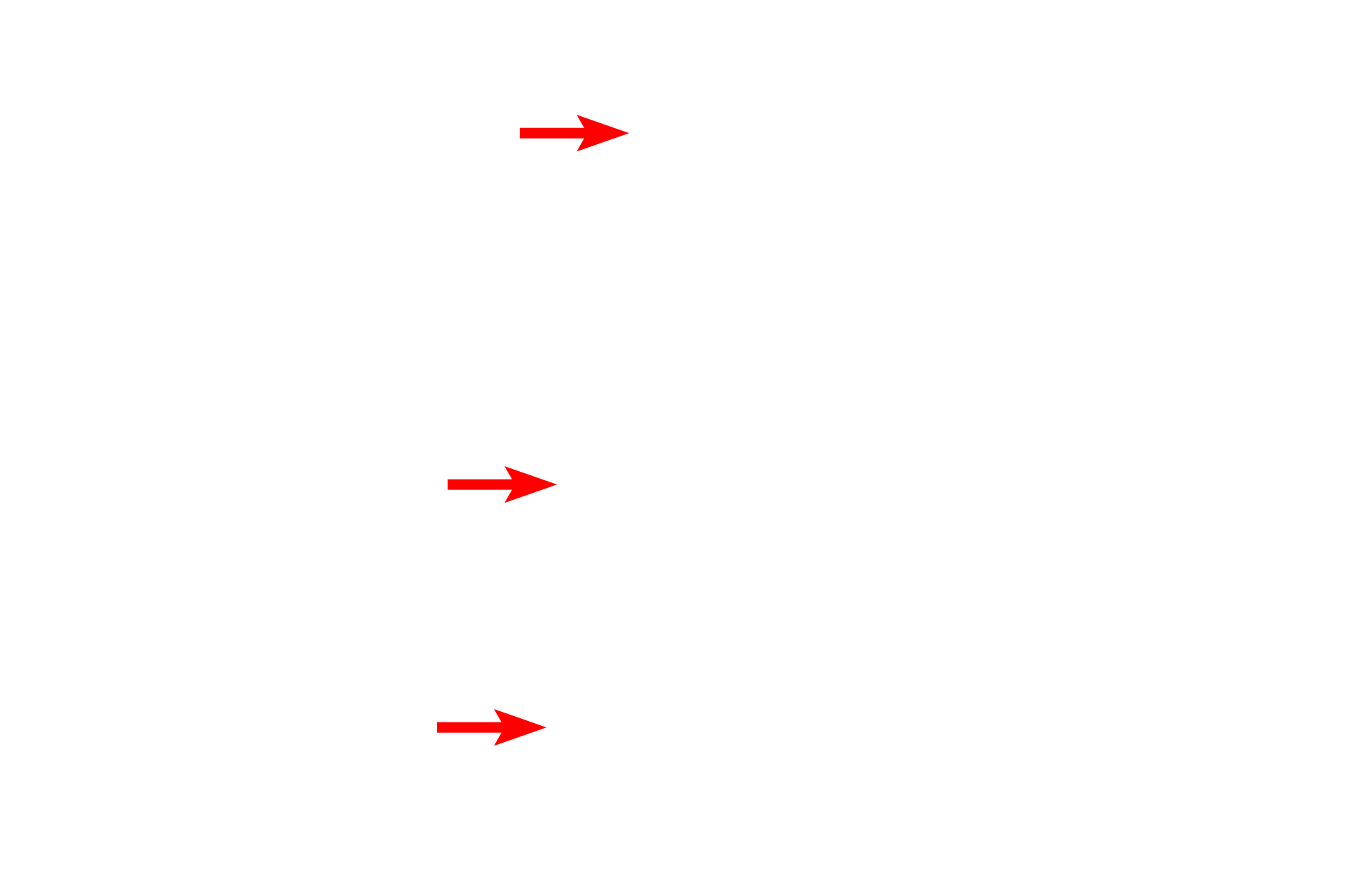 Dentino-enamel junction <p>The junction of the enamel (left) and dentin (right) is shown in this section of ground tooth.  The dentin is formed and maintained throughout life by odontoblasts that lie in the pulp cavity adjacent to the dentin.  Odontoblasts secrete matrix, investing their processes in dentinal tubules which span the thickness of the dentin.  200x</p>
