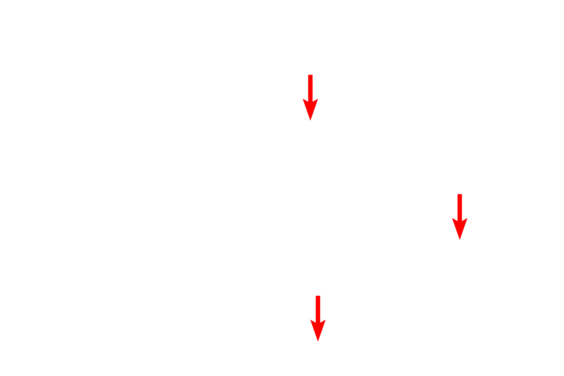  - Dentinal tubules <p>The junction of the enamel (left) and dentin (right) is shown in this section of ground tooth.  The dentin is formed and maintained throughout life by odontoblasts that lie in the pulp cavity adjacent to the dentin.  Odontoblasts secrete matrix, investing their processes in dentinal tubules which span the thickness of the dentin.  200x</p>
