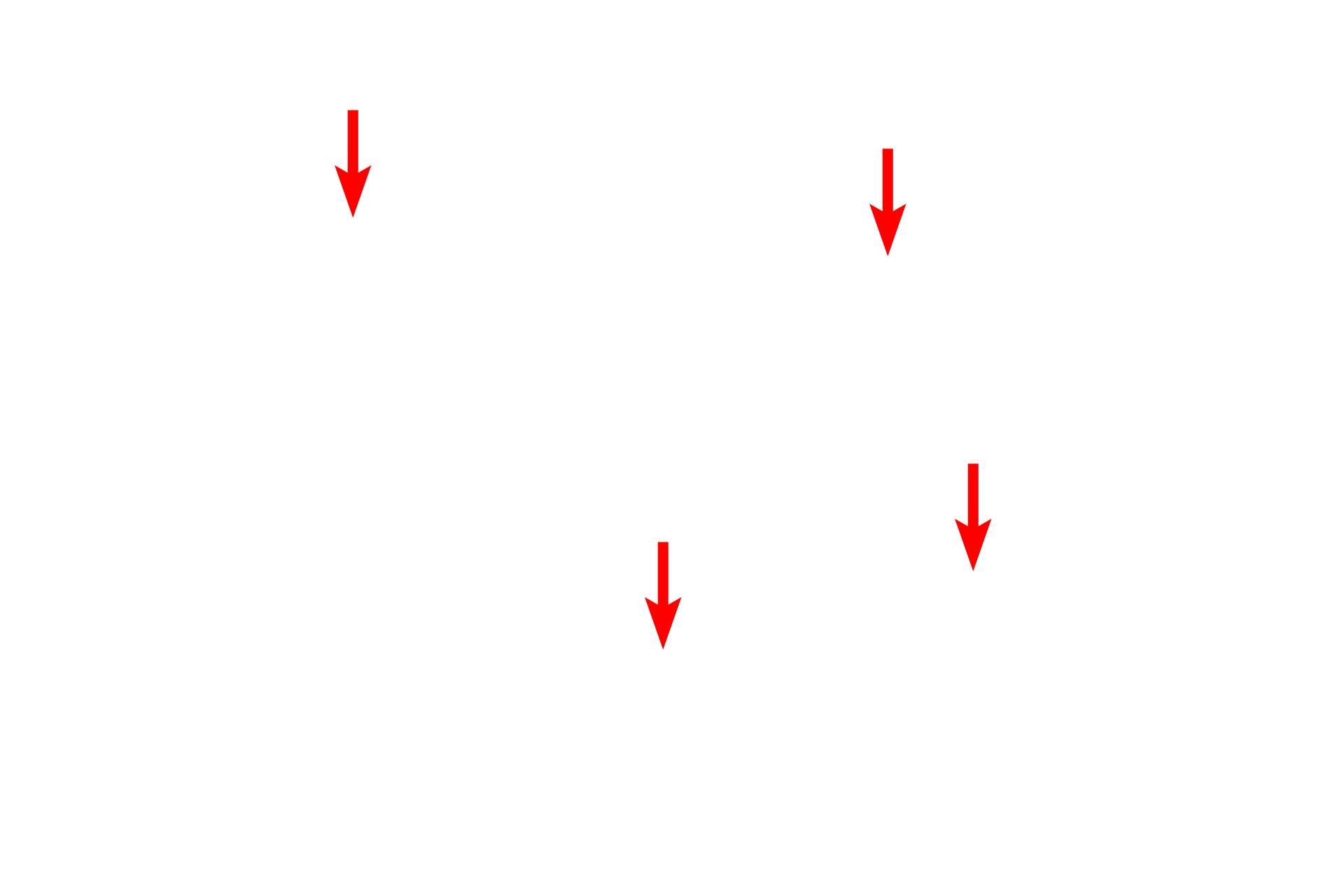  - Dentinal tubules <p>A section of ground tooth shows the dentin and the dentinal tubules.  Dentin is the most similar to bone of all the hard tissues of the tooth.  The dentinal tubules, housing odontoblast processes, form S-shaped curves and extend from the pulp chamber, where the odontoblasts are located, to the dentino-enamel or the dentino-cementum junctions.  200x</p>
