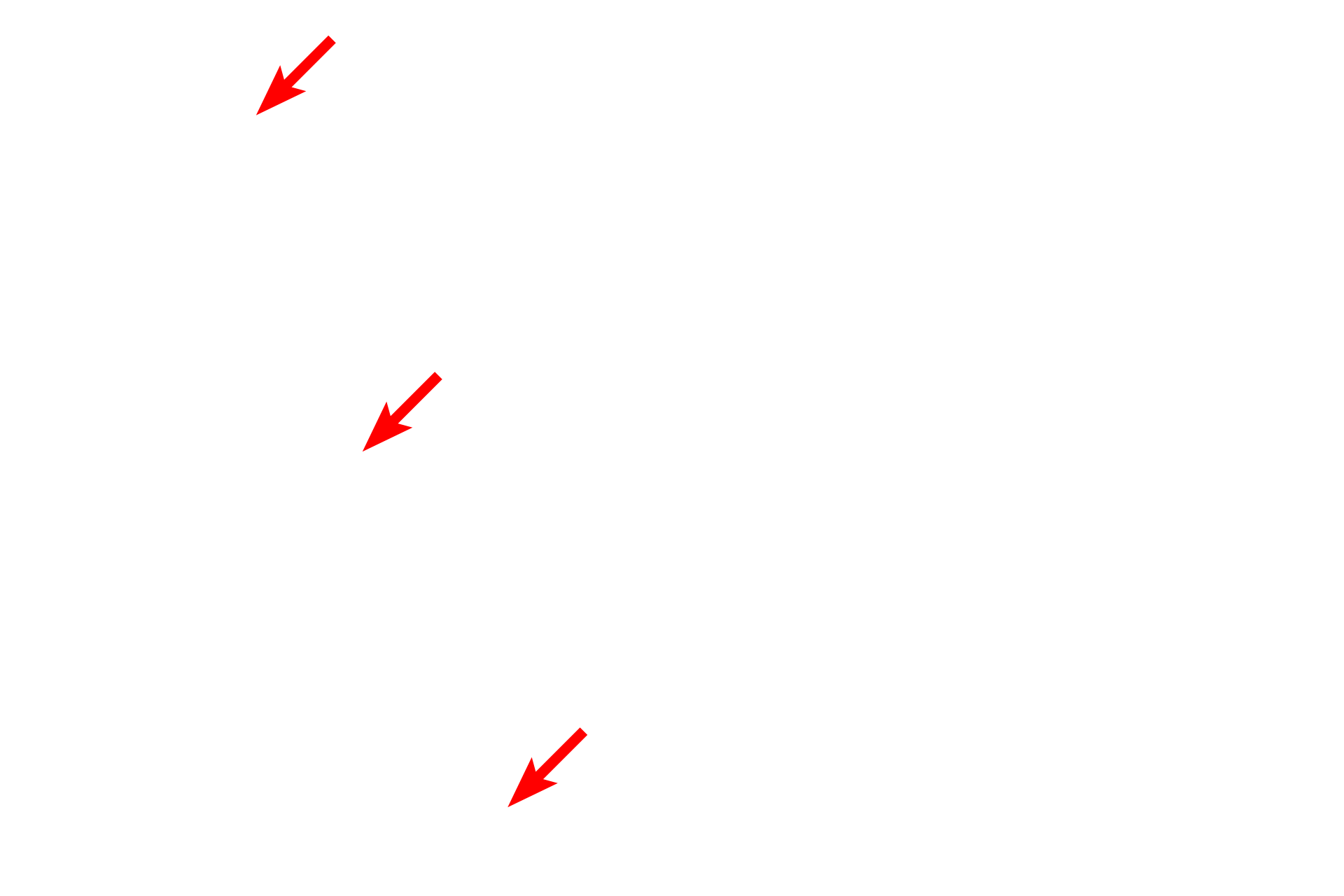 Dentino-enamel junction <p>A section of ground tooth shows the dentin and the dentinal tubules.  Dentin is the most similar to bone of all the hard tissues of the tooth.  The dentinal tubules, housing odontoblast processes, form S-shaped curves and extend from the pulp chamber, where the odontoblasts are located, to the dentino-enamel or the dentino-cementum junctions.  200x</p>
