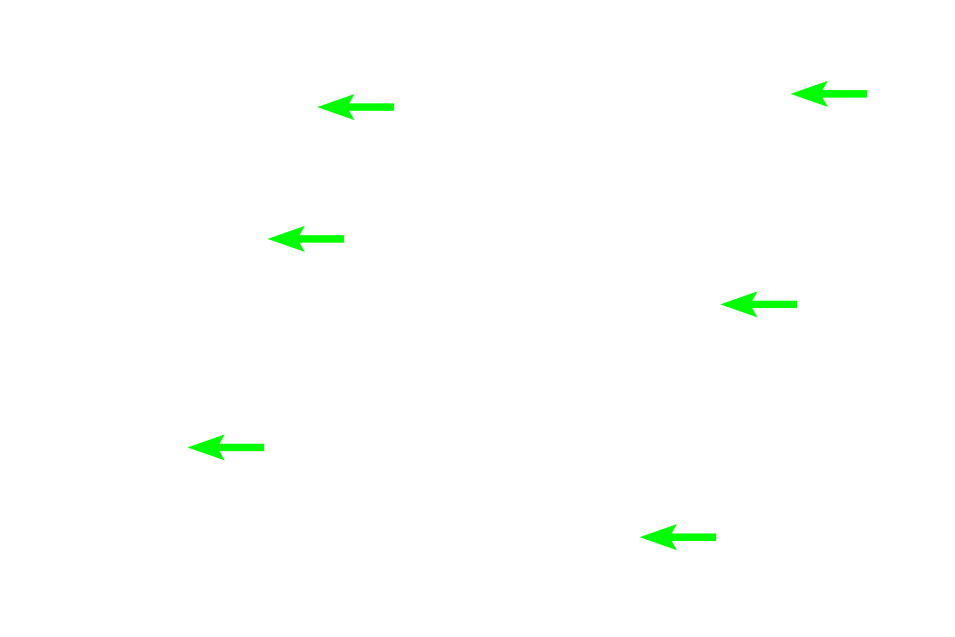 Predentin > <p>Dentin is deposited similarly to bone: organic matrix (predentin), deposited first, provides a framework on which hydroxyapatite is laid down to form dentin.  Dentin deposition surrounds long processes of odontoblasts, forming dentinal tubules.  Dentin formation begins at the dentino-enamel junction and proceeds into the pulp, decreasing the volume of pulp as it does so.</p>
