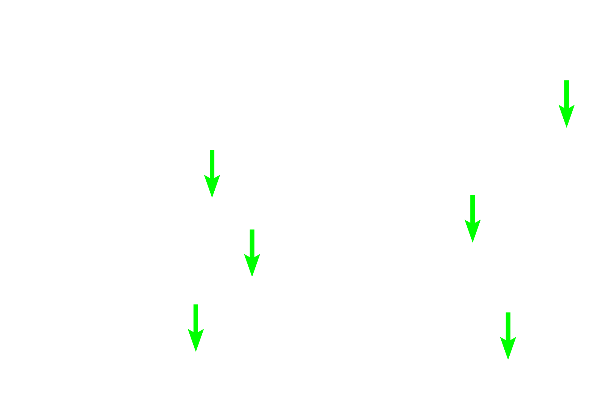  - Dentinal tubules <p>Dentin is deposited similarly to bone: organic matrix (predentin), deposited first, provides a framework on which hydroxyapatite is laid down to form dentin.  Dentin deposition surrounds long processes of odontoblasts, forming dentinal tubules.  Dentin formation begins at the dentino-enamel junction and proceeds into the pulp, decreasing the volume of pulp as it does so.</p>
