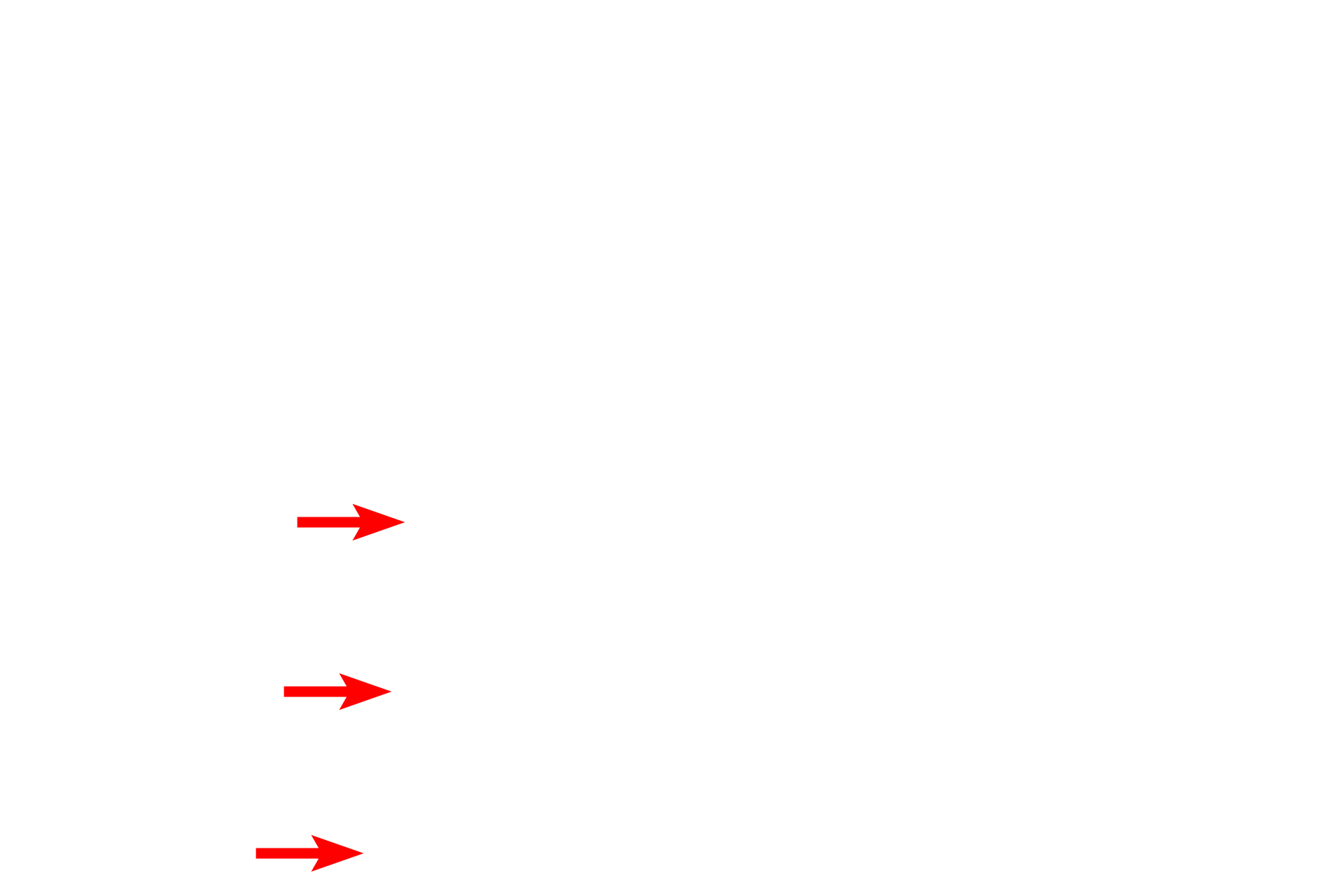 Cementum <p>This section of demineralized bone shows the junction of the enamel, dentin and cementum. Cementum is a thin layer of bone-like tissue that covers the dentin from this junction to the root of the tooth. The tooth is stabilized in the tooth socket by anchoring collagen fibers of the periodontal ligament, which extends from cementum to alveolar bone. 200x</p>
