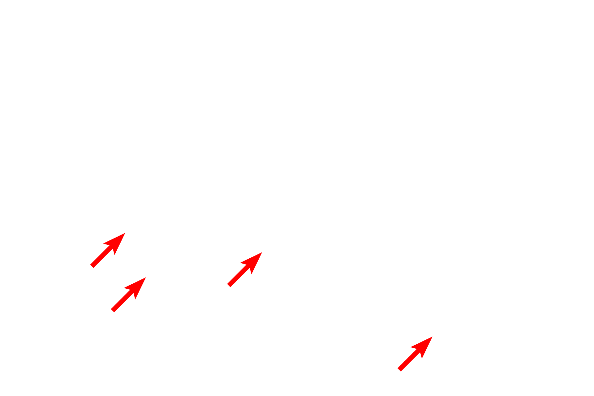 Esophageal glands proper <p>Stratified squamous moist epithelium lining the esophagus changes abruptly to a simple columnar epithelium forming the sheet gland of the stomach.  Esophageal glands proper, tubulo-acinar glands in the submucosa, continue into the stomach in this section.  100x</p>
