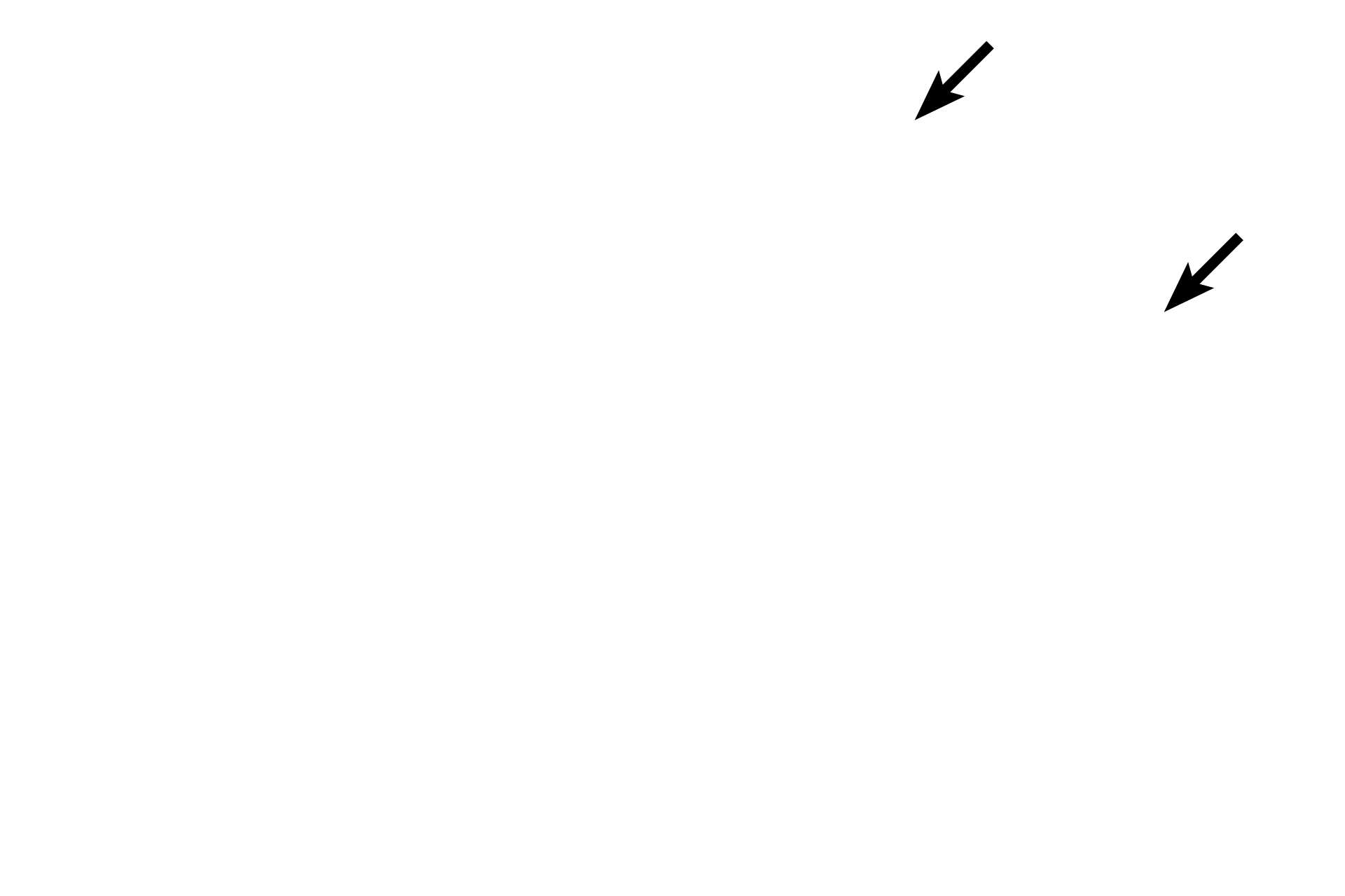  - Stratified squamous epithelium <p>Stratified squamous moist epithelium lining the esophagus changes abruptly to a simple columnar epithelium forming the sheet gland of the stomach.  Esophageal glands proper, tubulo-acinar glands in the submucosa, continue into the stomach in this section.  100x</p>
