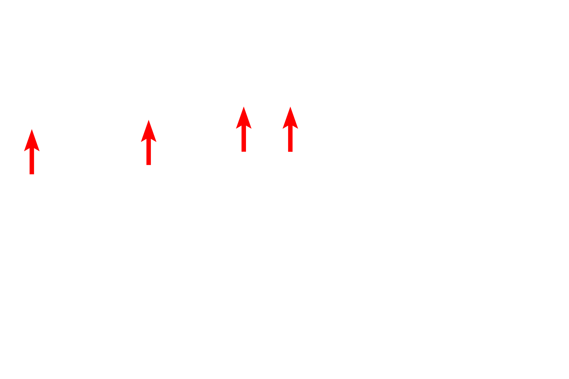  - Cardiac glands <p>Stratified squamous moist epithelium lining the esophagus changes abruptly to a simple columnar epithelium forming the sheet gland of the stomach.  Esophageal glands proper, tubulo-acinar glands in the submucosa, continue into the stomach in this section.  100x</p>
