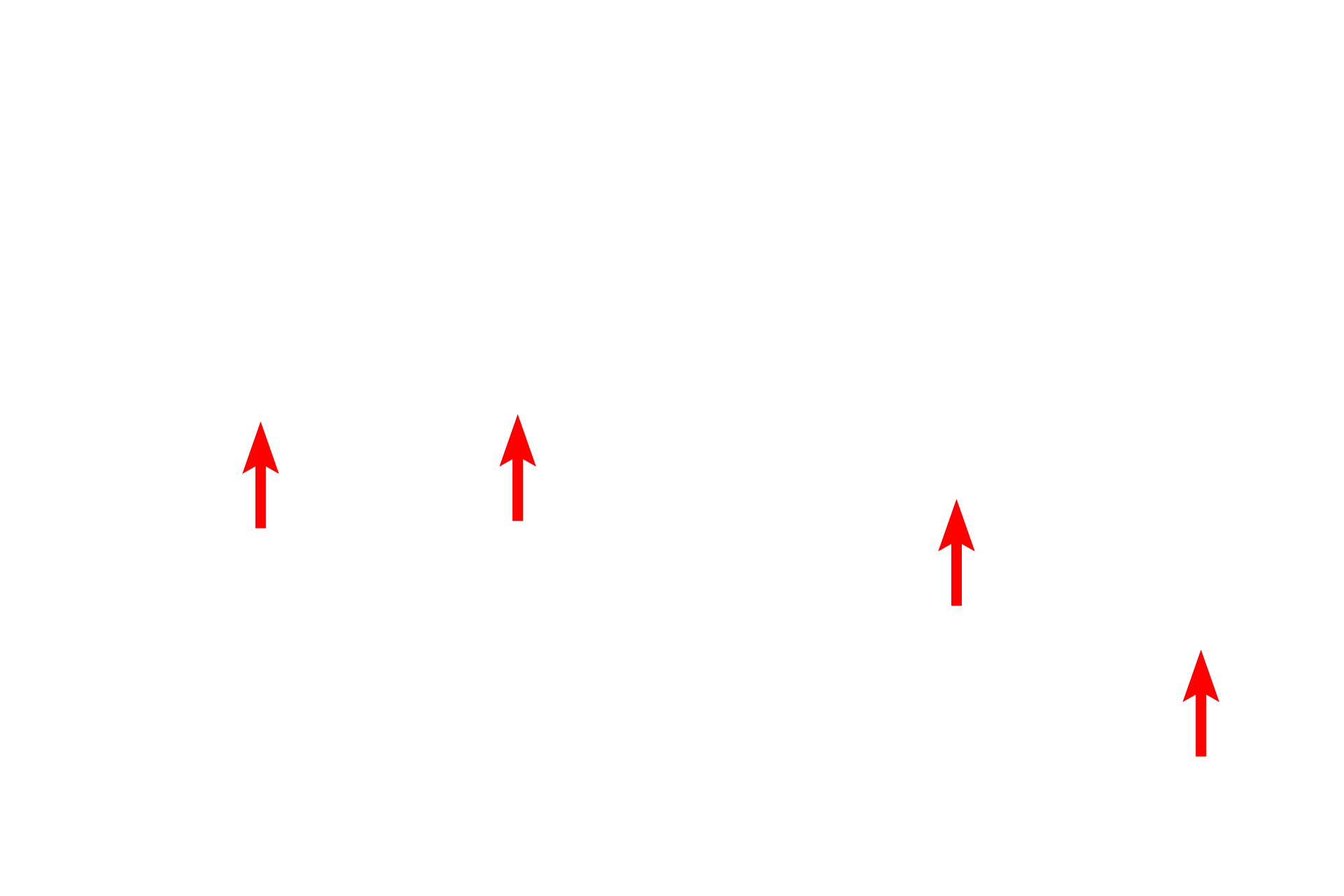 Muscularis mucosae <p>Stratified squamous moist epithelium lining the esophagus changes abruptly to a simple columnar epithelium forming the sheet gland of the stomach.  Esophageal glands proper, tubulo-acinar glands in the submucosa, continue into the stomach in this section.  100x</p>
