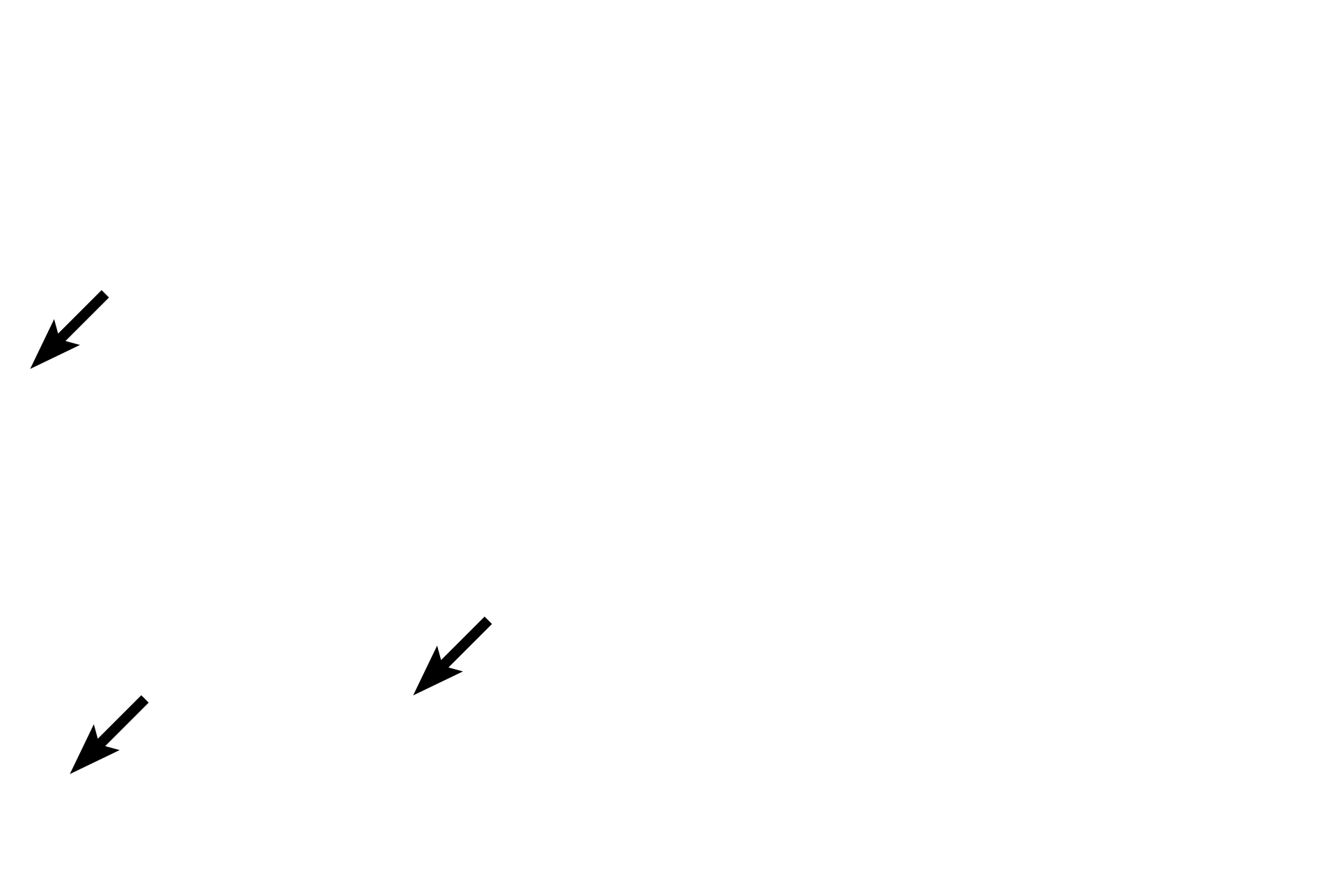 Lamina propria <p>A thick stratified squamous nonkeratinized (moist) epithelium lines the esophagus, providing protection for the organ during food transport. Its moist surface, together with secretions from glands in the lamina propria and submucosa, provide lubrication. The epithelium is not keratinized and nucleated cells remain at the surface of this epithelium.  400x</p>
