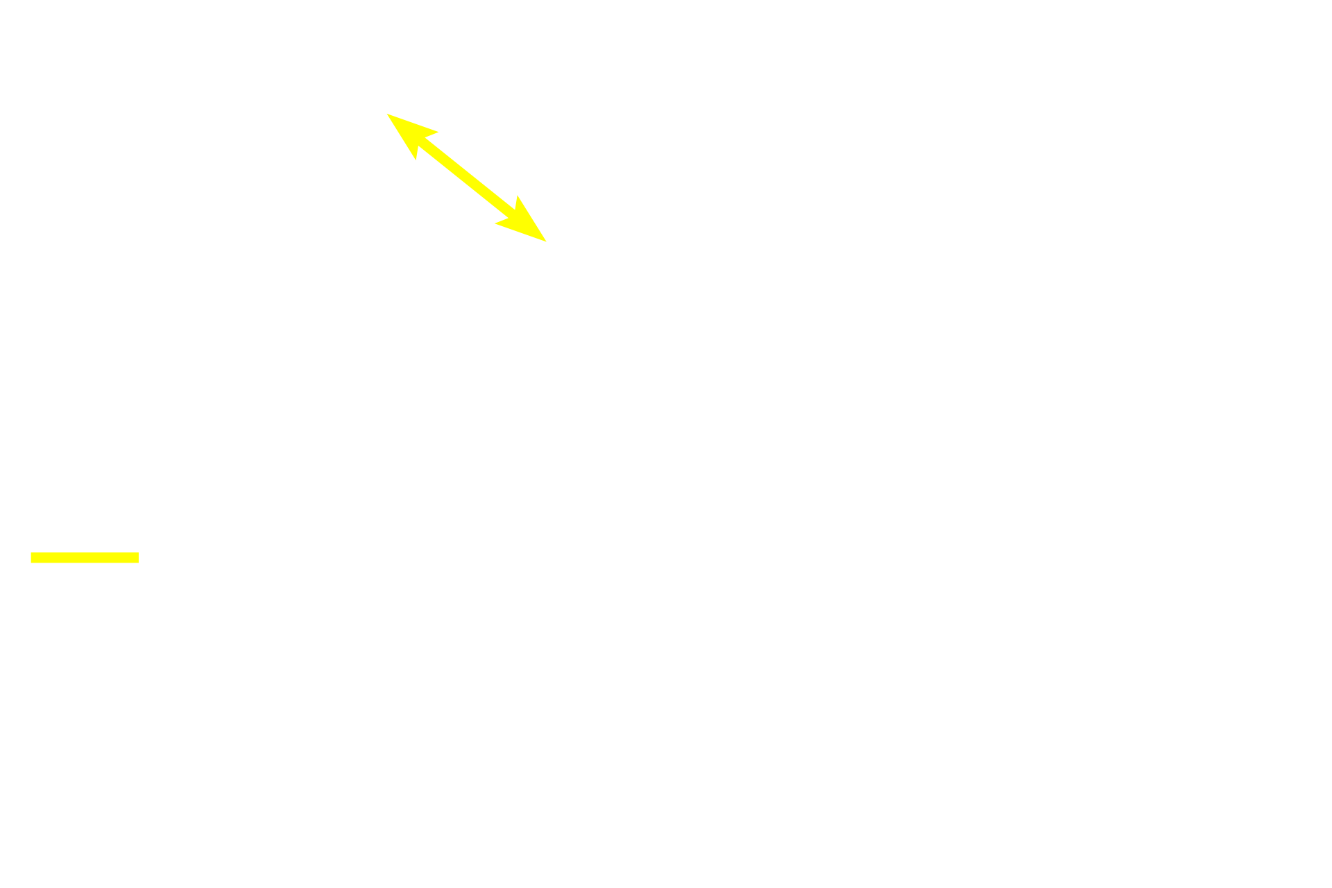  - Epithelium <p>A thick stratified squamous nonkeratinized epithelium lines the esophagus.  The lamina propria underlying the epithelium possesses lymphoid structures and localized mucous glands (not shown here) in the lower third and sometimes in the upper third. The muscularis mucosae is usually absent in the upper third. Additional tubulo-acinar glands, esophageal glands proper, are located in the submucosa.  100x</p>

