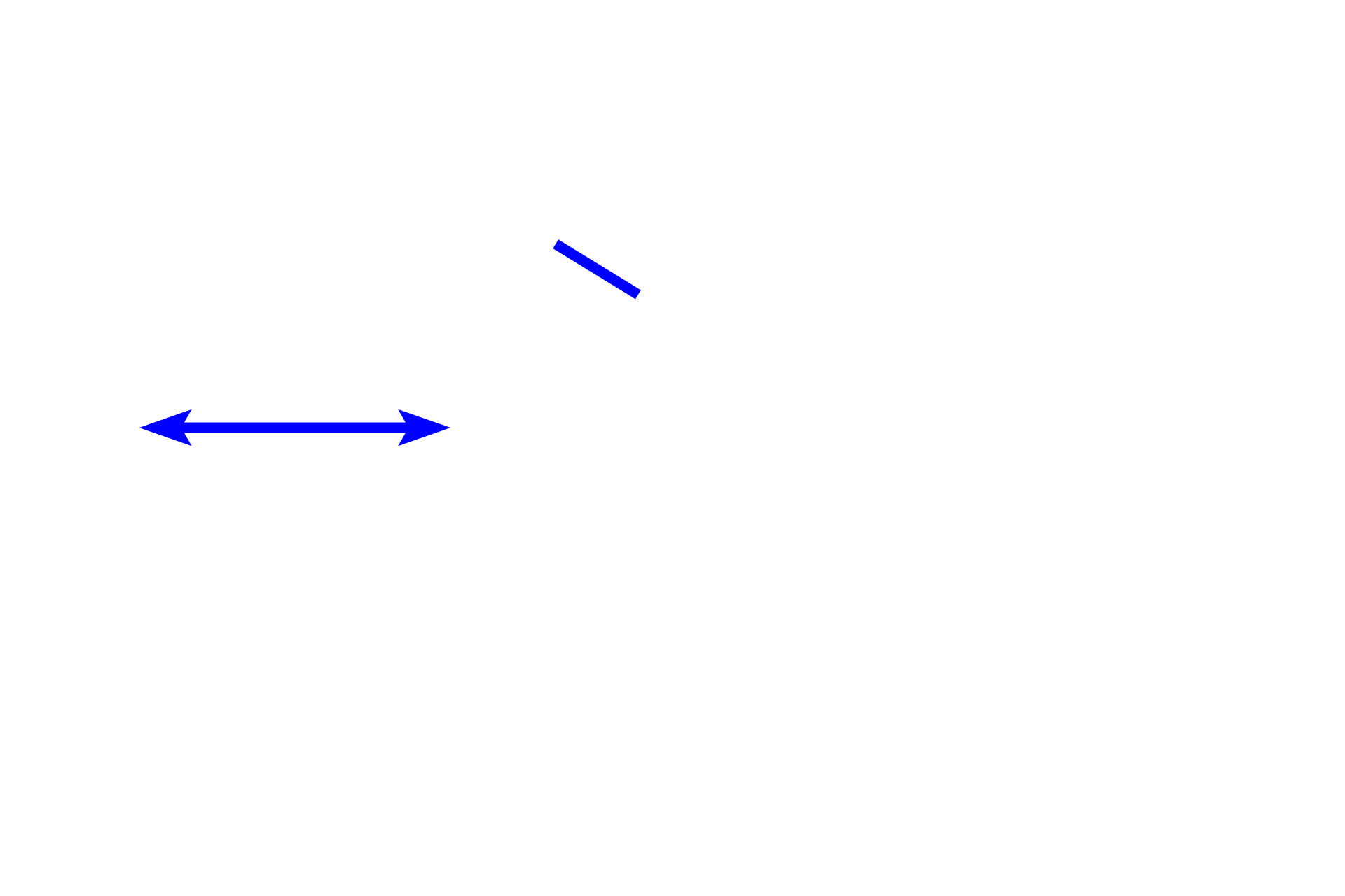  - Lamina propria <p>A thick stratified squamous nonkeratinized epithelium lines the esophagus.  The lamina propria underlying the epithelium possesses lymphoid structures and localized mucous glands (not shown here) in the lower third and sometimes in the upper third. The muscularis mucosae is usually absent in the upper third. Additional tubulo-acinar glands, esophageal glands proper, are located in the submucosa.  100x</p>
