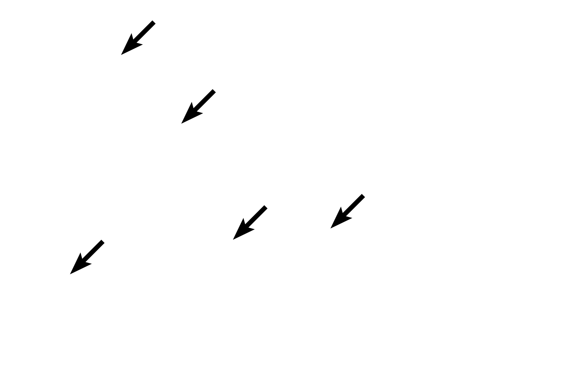 Venules and small veins <p>This image shows a higher magnification of the mucosa. The lamina propria contains numerous small veins and lymphatics. A thick muscularis mucosae of smooth muscle is present.  This is a longitudinal section of the esophagus and thus the circularly-arranged smooth muscle fibers are seen in cross section.  200x</p>
