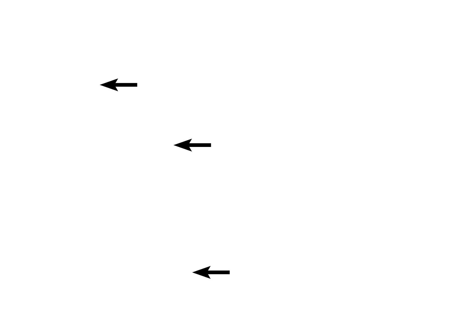 Lymph vessels <p>This image shows a higher magnification of the mucosa. The lamina propria contains numerous small veins and lymphatics. A thick muscularis mucosae of smooth muscle is present.  This is a longitudinal section of the esophagus and thus the circularly-arranged smooth muscle fibers are seen in cross section.  200x</p>
