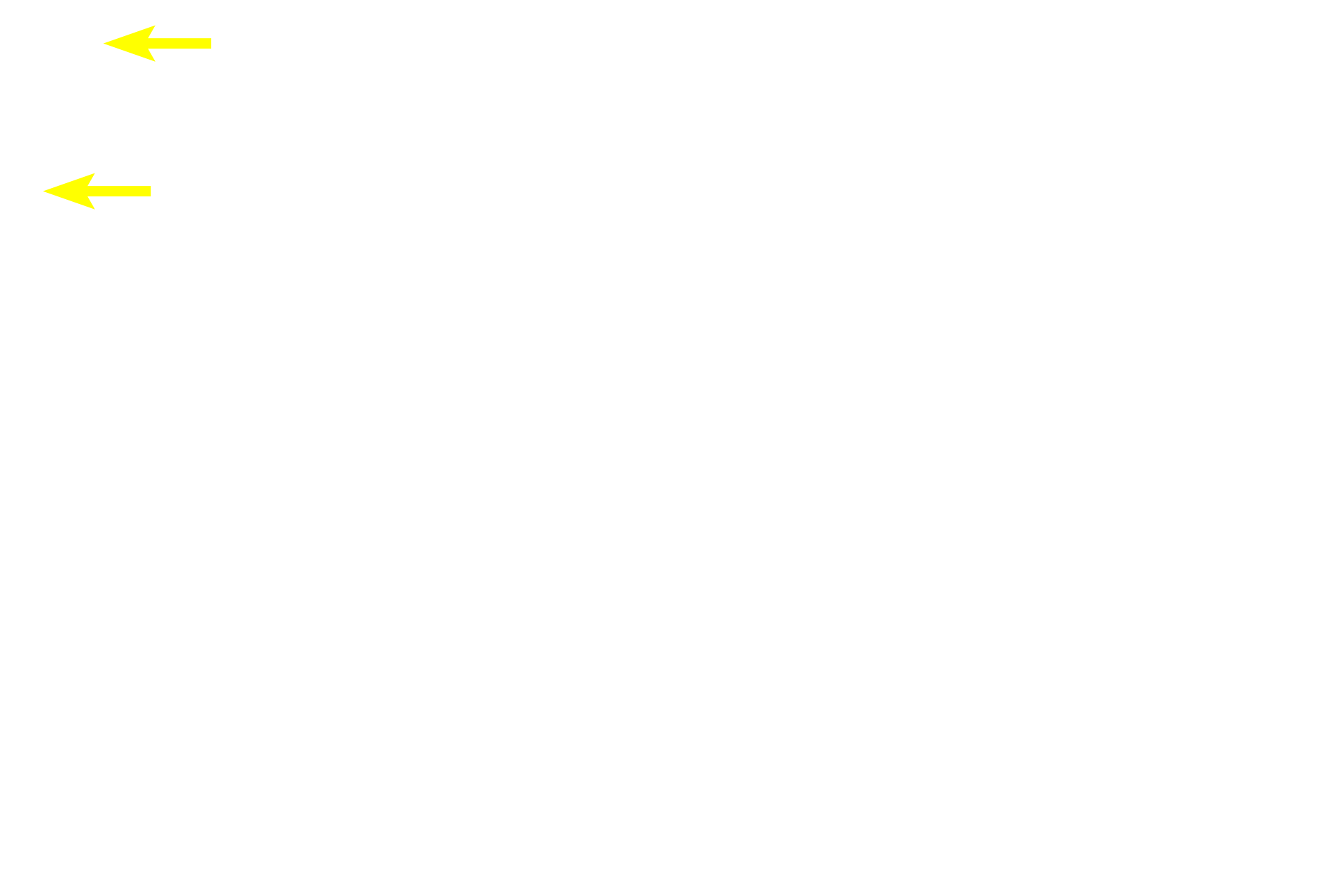 Submucosa <p>Muscularis externa is formed of inner circular and outer longitudinal muscle layers that produce propulsive peristaltic waves of contraction.  In the upper third of the esophagus, these layers are formed of skeletal muscle, which is involved with swallowing, a voluntary action.  In the middle one-third (seen here), skeletal and smooth muscles are intermixed.  In the lower one-third, only smooth muscle is present.  Innervation is provided by the myenteric (Auerbach’s) plexus.  400x</p>
