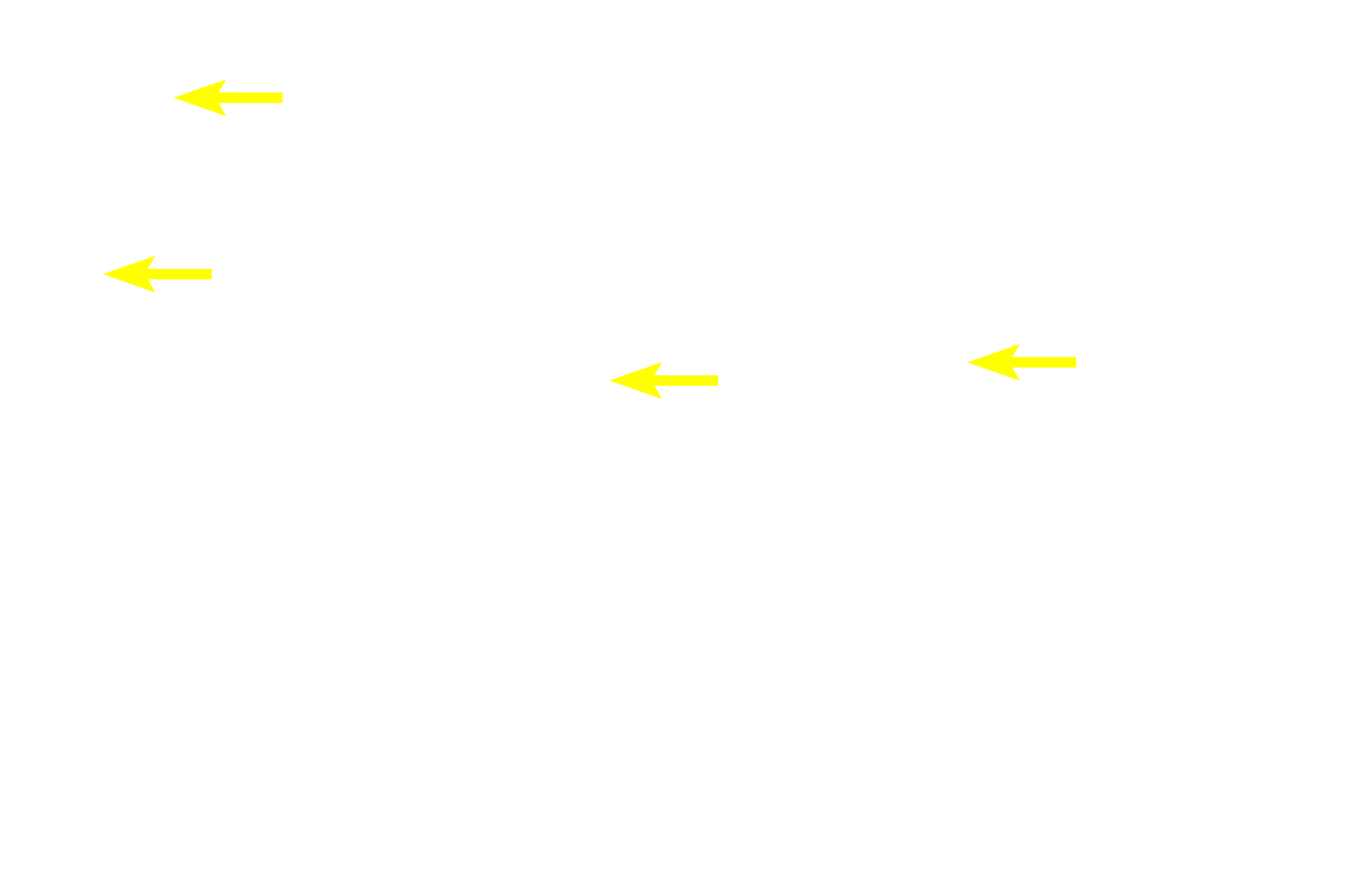  - Smooth muscle longitudinal section <p>Muscularis externa is formed of inner circular and outer longitudinal muscle layers that produce propulsive peristaltic waves of contraction.  In the upper third of the esophagus, these layers are formed of skeletal muscle, which is involved with swallowing, a voluntary action.  In the middle one-third (seen here), skeletal and smooth muscles are intermixed.  In the lower one-third, only smooth muscle is present.  Innervation is provided by the myenteric (Auerbach’s) plexus.  400x</p>
