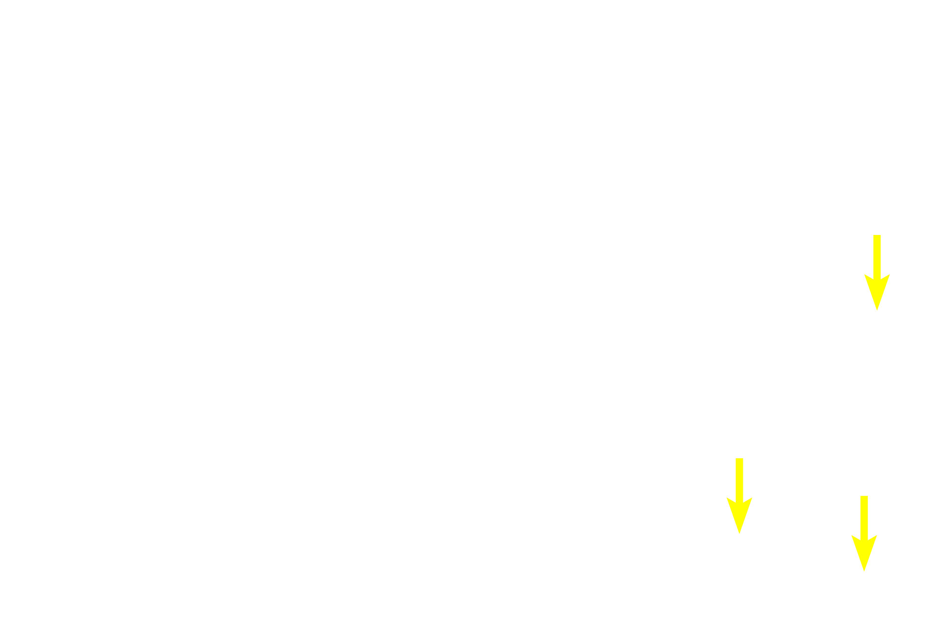  - Skeletal muscle cross section <p>Muscularis externa is formed of inner circular and outer longitudinal muscle layers that produce propulsive peristaltic waves of contraction.  In the upper third of the esophagus, these layers are formed of skeletal muscle, which is involved with swallowing, a voluntary action.  In the middle one-third (seen here), skeletal and smooth muscles are intermixed.  In the lower one-third, only smooth muscle is present.  Innervation is provided by the myenteric (Auerbach’s) plexus.  400x</p>
