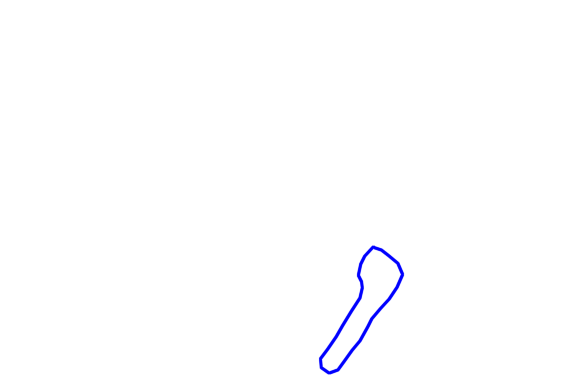  - Myenteric (Auerbach’s) plexus  <p>Muscularis externa is formed of inner circular and outer longitudinal muscle layers that produce propulsive peristaltic waves of contraction.  In the upper third of the esophagus, these layers are formed of skeletal muscle, which is involved with swallowing, a voluntary action.  In the middle one-third (seen here), skeletal and smooth muscles are intermixed.  In the lower one-third, only smooth muscle is present.  Innervation is provided by the myenteric (Auerbach’s) plexus.  400x</p>
