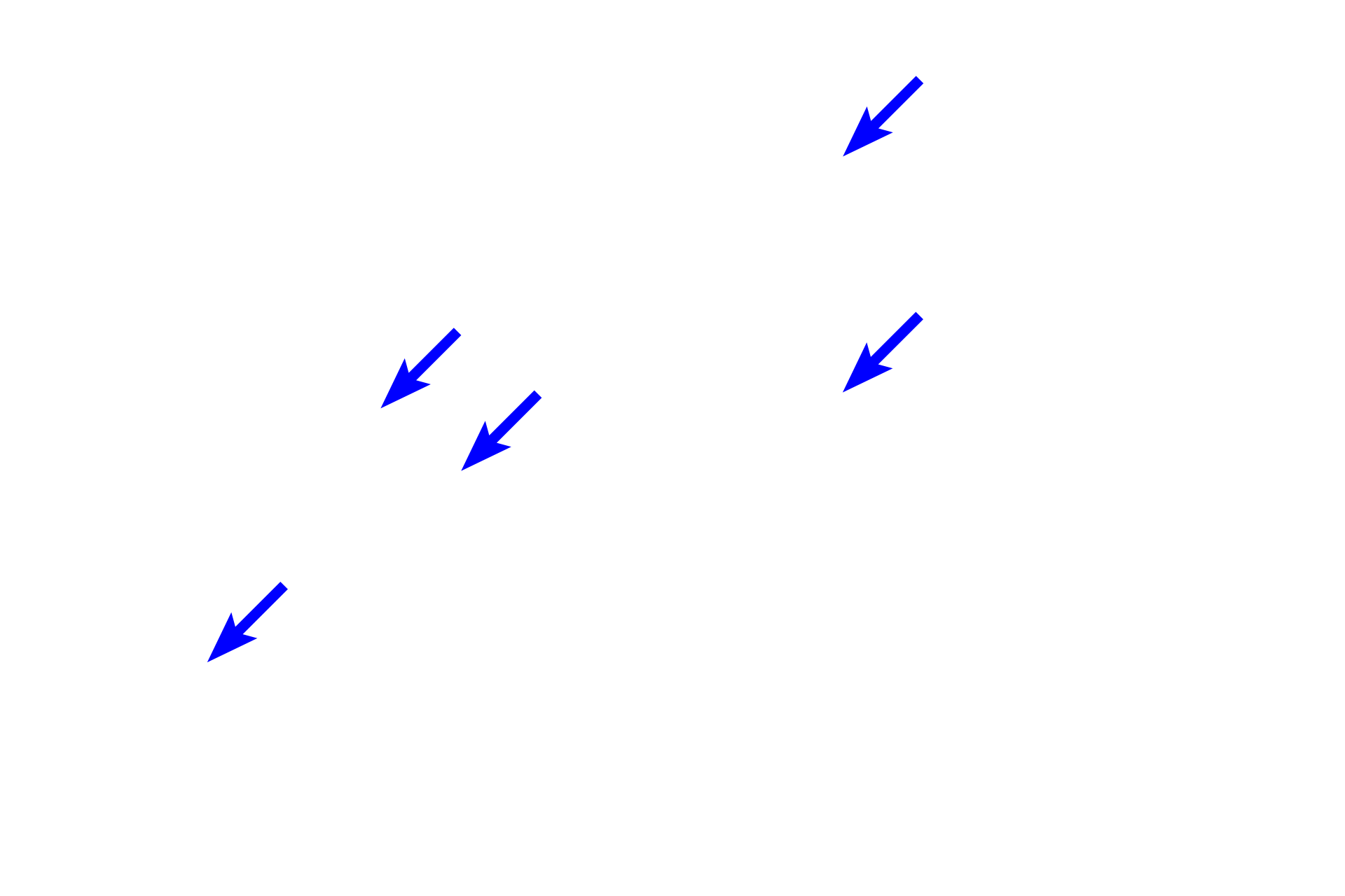 Striations <p>In the middle part of the muscularis externa of the esophagus, smooth muscle fibers and skeletal muscle fibers occur together.  In this field, compare the size of the fibers and location of the nuclei of these two muscle types.  Striations are also evident in the longitudinally-sectioned skeletal muscle fibers.  1000x</p>

