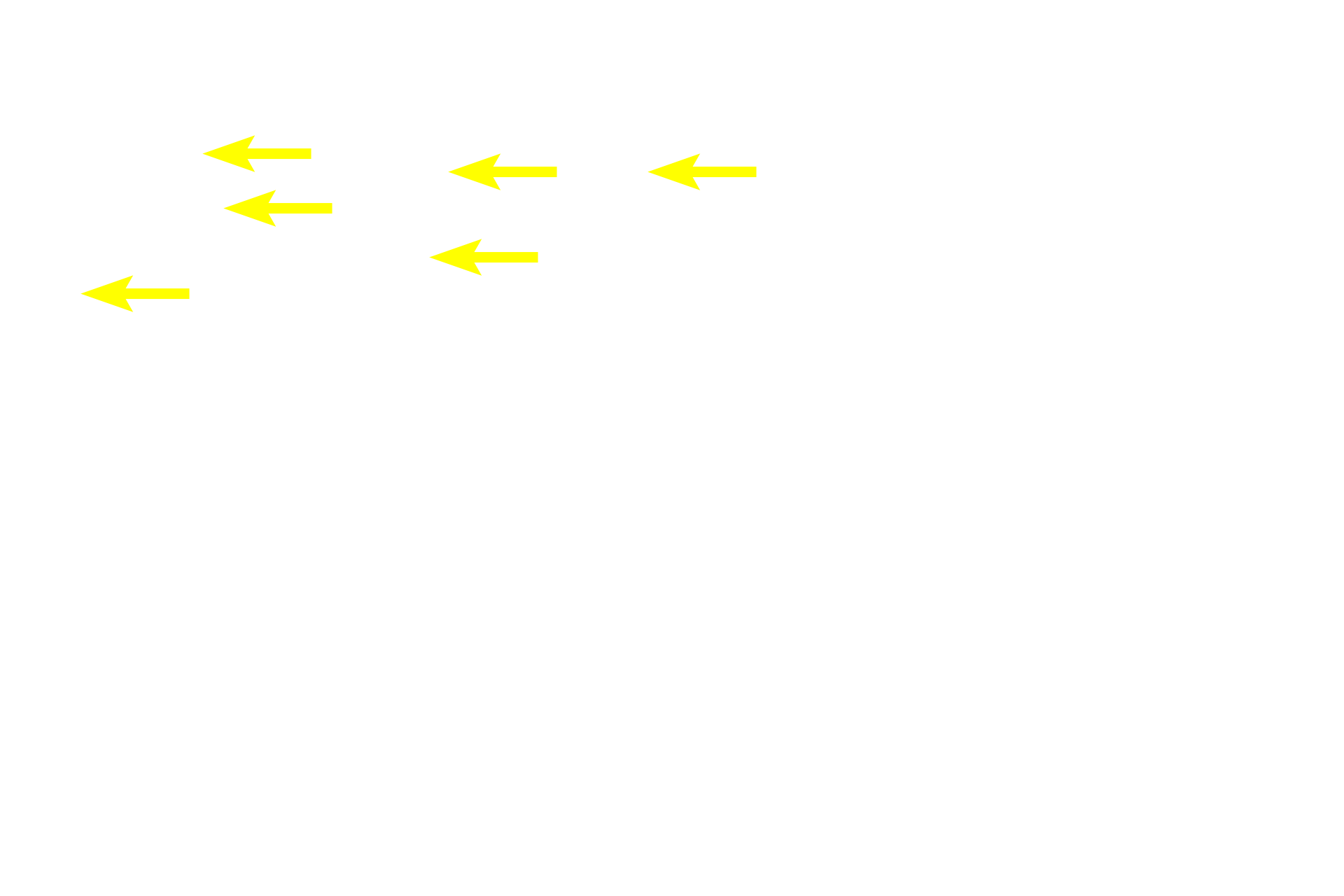 Gastric pits <p>A sharp transition in the mucosal epithelium, from stratified squamous moist (esophagus, right) to simple columnar (cardiac stomach, left), marks the transition of these two organs.  Additional features of the stomach include the presence of gastric pits extending from the surface into the gastric glands in the lamina propria.  This region is also referred to as the gastro-esophageal junction.  40x</p>
