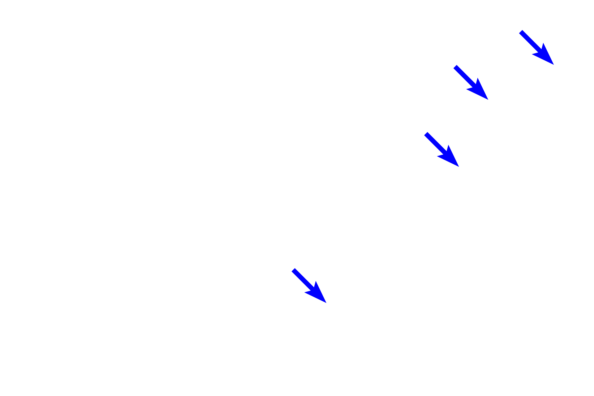  - Intestinal glands <p>The mucosa of the appendix resembles that of the colon; straight intestinal glands are located in the lamina propria; villi are not present.  Abundant diffuse and nodular lymphoid tissue infiltrate the appendix.  400x</p>
