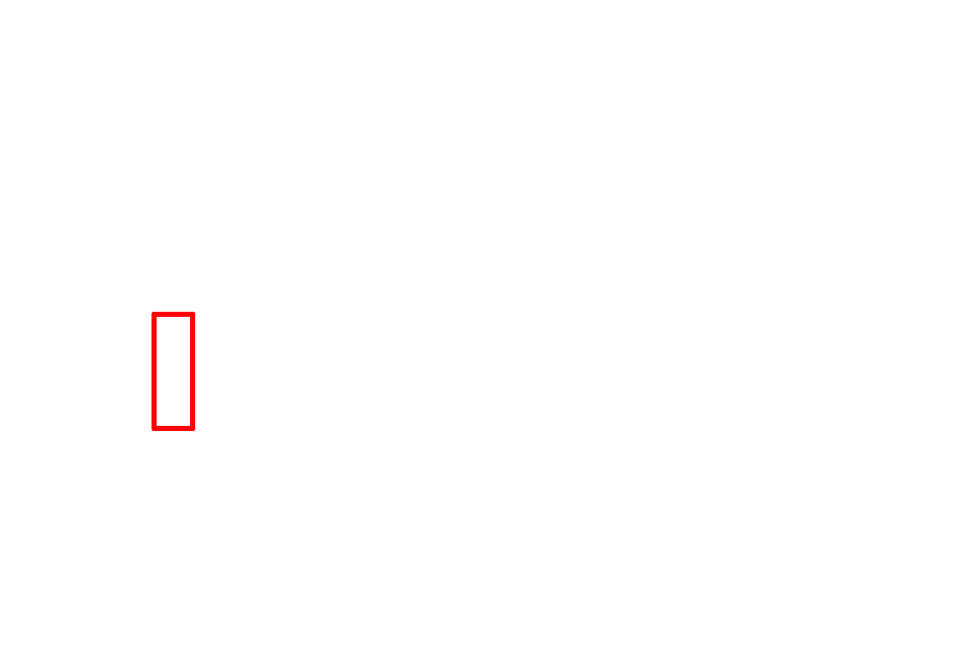 Recto-anal junction <p>The epithelium changes abruptly at the junction of the rectum (simple columnar) with the anal canal (stratified squamous moist).  The rectum resembles the rest of the large intestine, having straight intestinal glands with many goblet cells.   A more gradual transition of the epithelium occurs between the anal canal and the anus, the latter being lined by a stratified squamous, keratinized epithelium.  100x</p>
