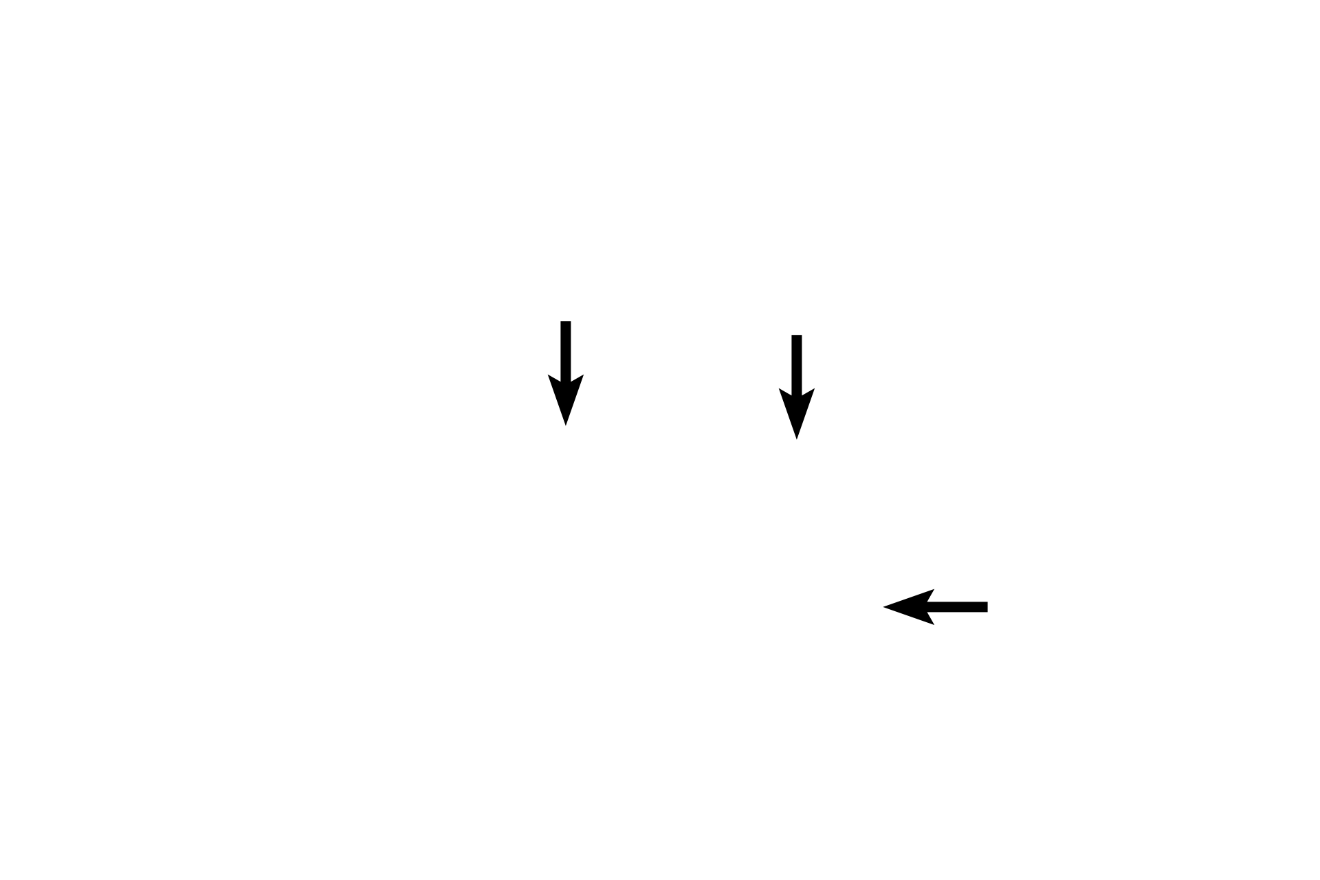 Stratified squamous moist epithelium <p>These images compare the recto-anal junction (left) with the junction of the anal canal with the anus (right).  For the recto-anal junction, the transition from simple columnar epithelium with goblet cells of the rectum to the stratified squamous moist epithelium of the anal canal is abrupt.  The junction of the anal canal with the anus, lined by a keratinized stratified squamous epithelium, is a bit more gradual.  400x</p>
