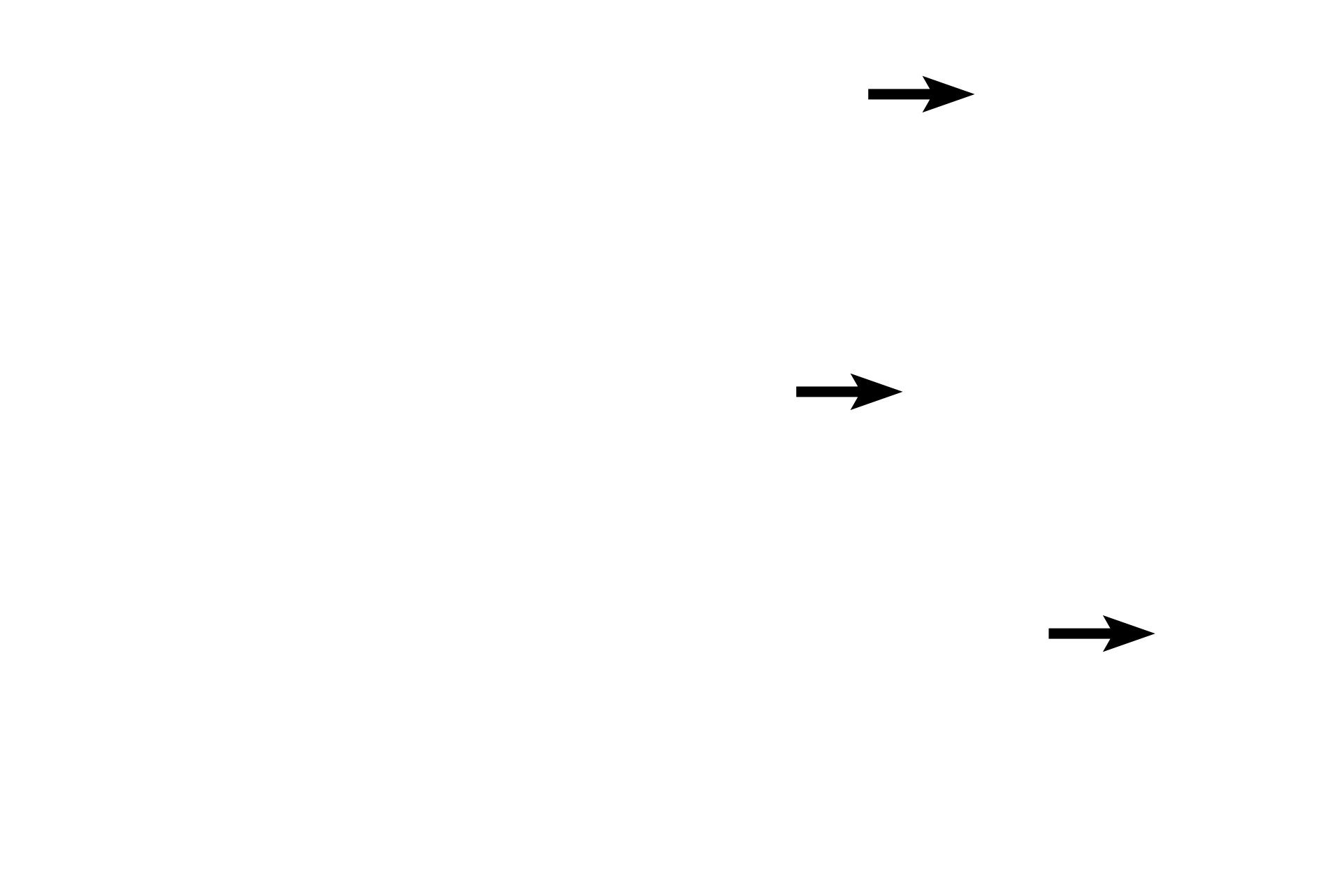 Stratified squamous, keratinized (dry) epithelium <p>These images compare the recto-anal junction (left) with the junction of the anal canal with the anus (right).  For the recto-anal junction, the transition from simple columnar epithelium with goblet cells of the rectum to the stratified squamous moist epithelium of the anal canal is abrupt.  The junction of the anal canal with the anus, lined by a keratinized stratified squamous epithelium, is a bit more gradual.  400x</p>
