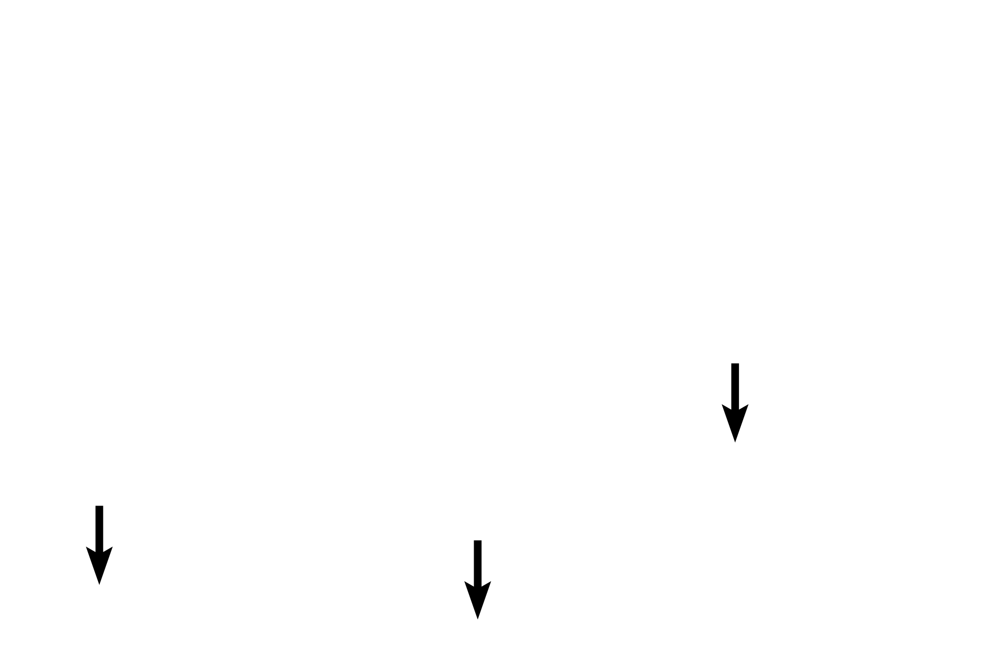 Muscularis externa outer layer <p>The epithelium changes abruptly at the junction of the rectum (simple columnar) with the anal canal (stratified squamous moist); a more gradual transition occurs between the anal canal and anus.  The inner circular layer of the muscularis externa thickens terminally as the internal anal sphincter.  The outer longitudinal band blends with the adventitia.  The external anal sphincter is composed of skeletal muscle.  40x</p>
