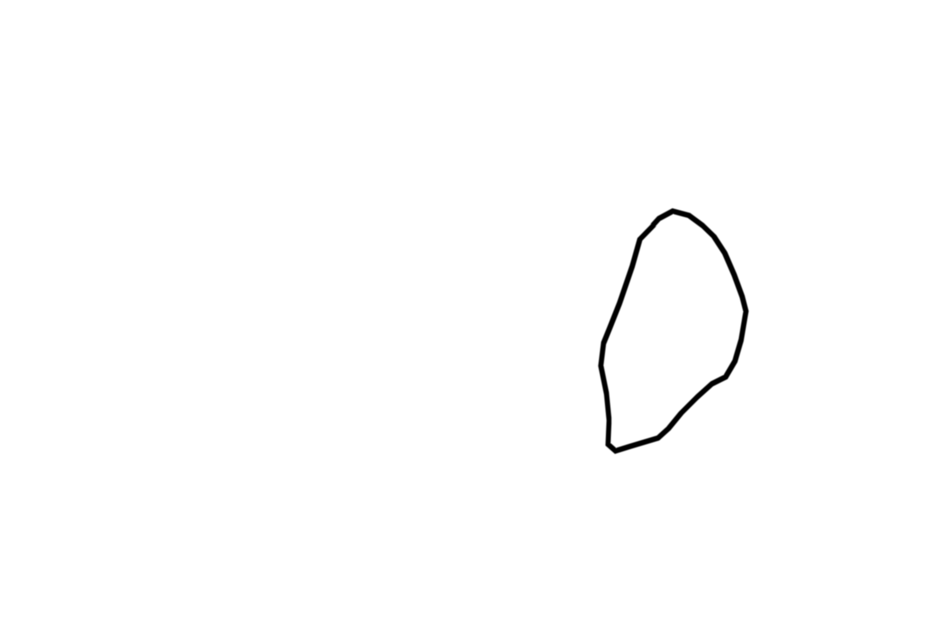 Internal anal sphincter <p>The epithelium changes abruptly at the junction of the rectum (simple columnar) with the anal canal (stratified squamous moist); a more gradual transition occurs between the anal canal and anus.  The inner circular layer of the muscularis externa thickens terminally as the internal anal sphincter.  The outer longitudinal band blends with the adventitia.  The external anal sphincter is composed of skeletal muscle.  40x</p>
