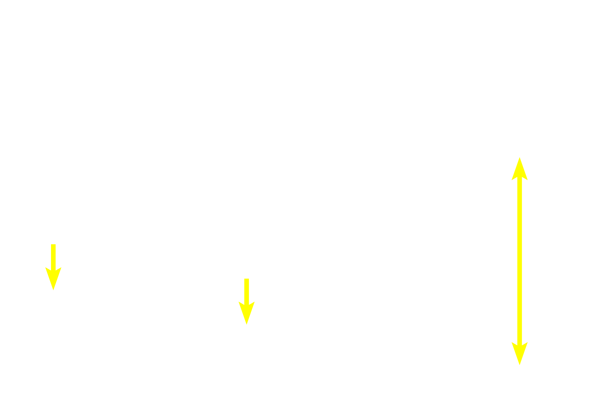  - Outer muscularis externa <p>This image shows the layers of the large intestine at higher magnification.  400x</p>
