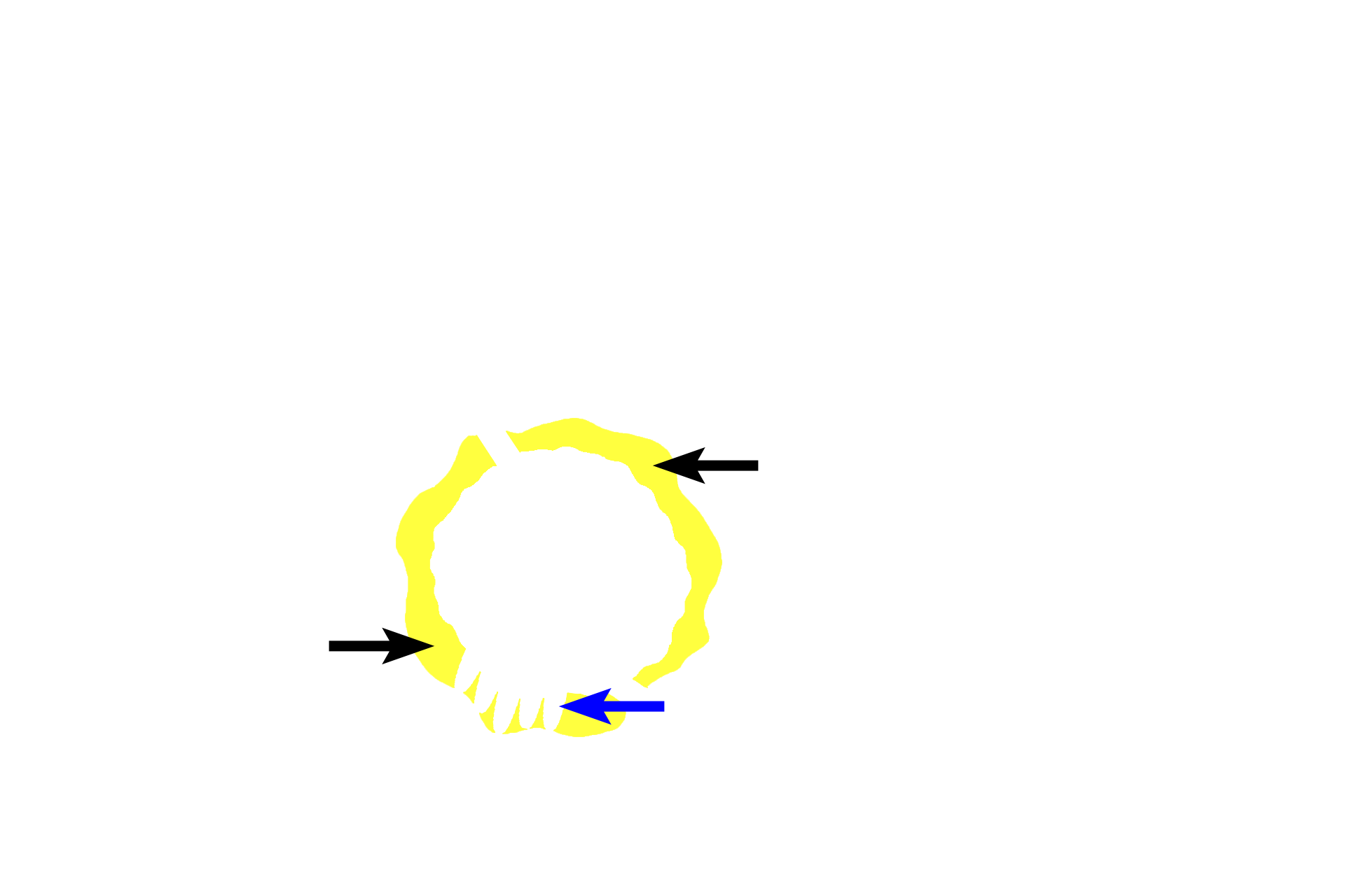  - Lamina propria > <p>The lamina propria (yellow arrows) is a layer of loose connective tissue immediately beneath the epithelium.  Frequently, glands (blue arrow) will be present in this layer; these glands open onto the surface of the epithelium.  Diffuse and nodular lymphoid tissue (MALT, mucosa-associated lymphoid tissue) may be located in the lamina propria also.</p>
