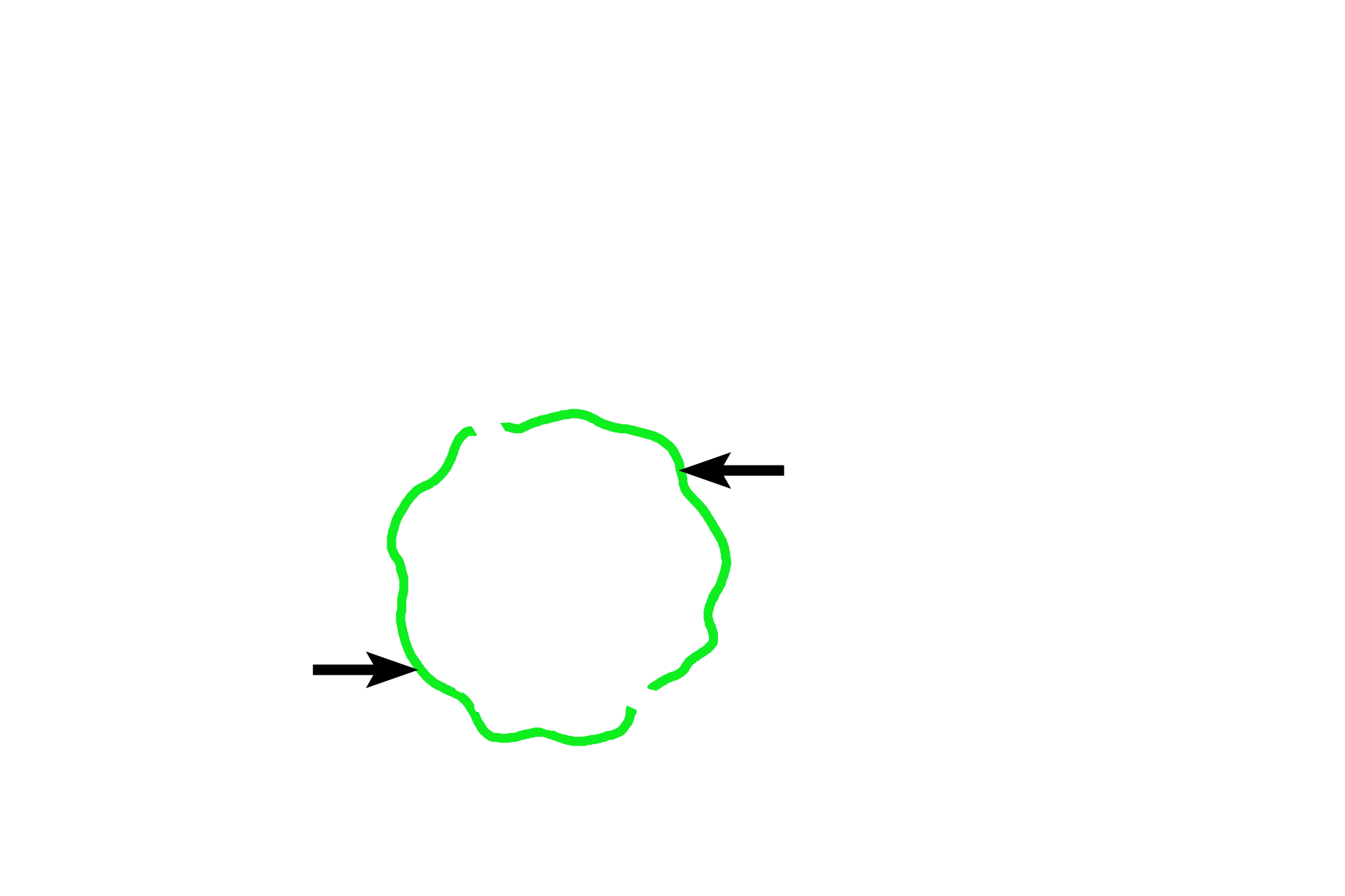  - Muscularis mucosae > <p>The muscularis mucosae (literally, muscle of the mucosa) is composed of smooth muscle; this layer may be lacking or incomplete in some organs of the digestive tract.</p>
