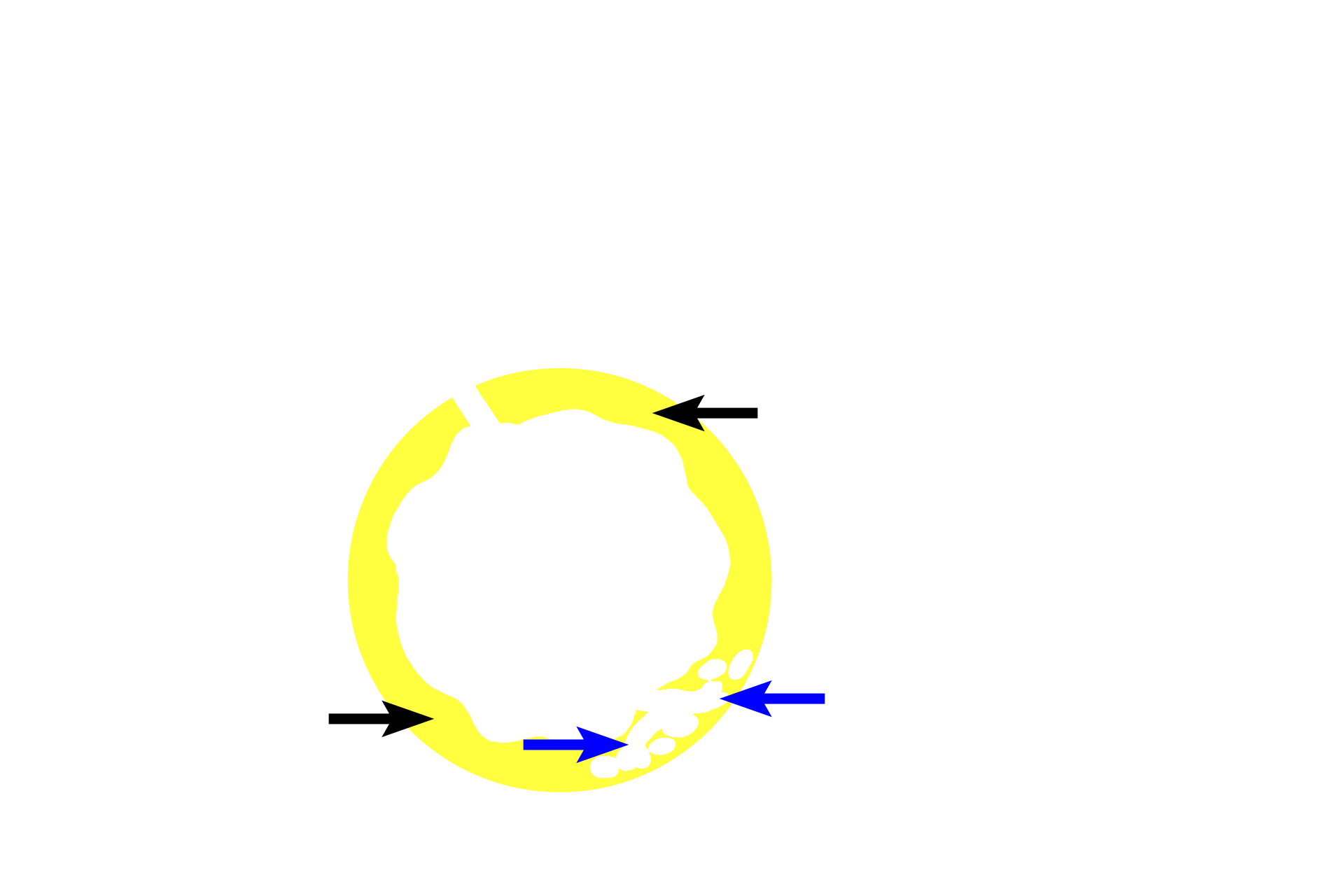 Submucosa > <p>The submucosa (black arrows) is composed of dense connective tissue.  Glands (blue arrows) may be present in the submucosa; these glands also open onto the epithelial surface.</p>
