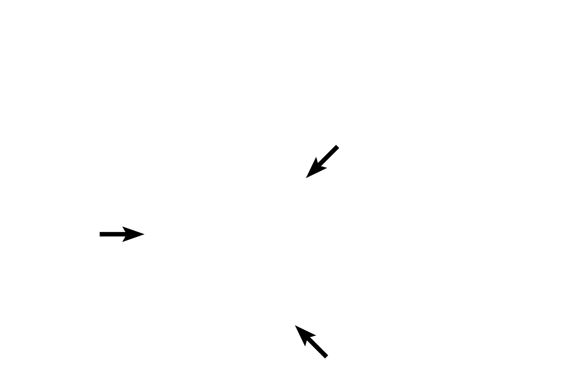  - Inner circular layer <p>The muscularis externa, the third tunic, is usually composed of smooth muscle. Most frequently, this smooth muscle is arranged into an inner circular and an outer longitudinal layer. It is responsible for producing propulsive peristaltic waves of contraction as well as mixing of the luminal contents (segmentation).</p>
