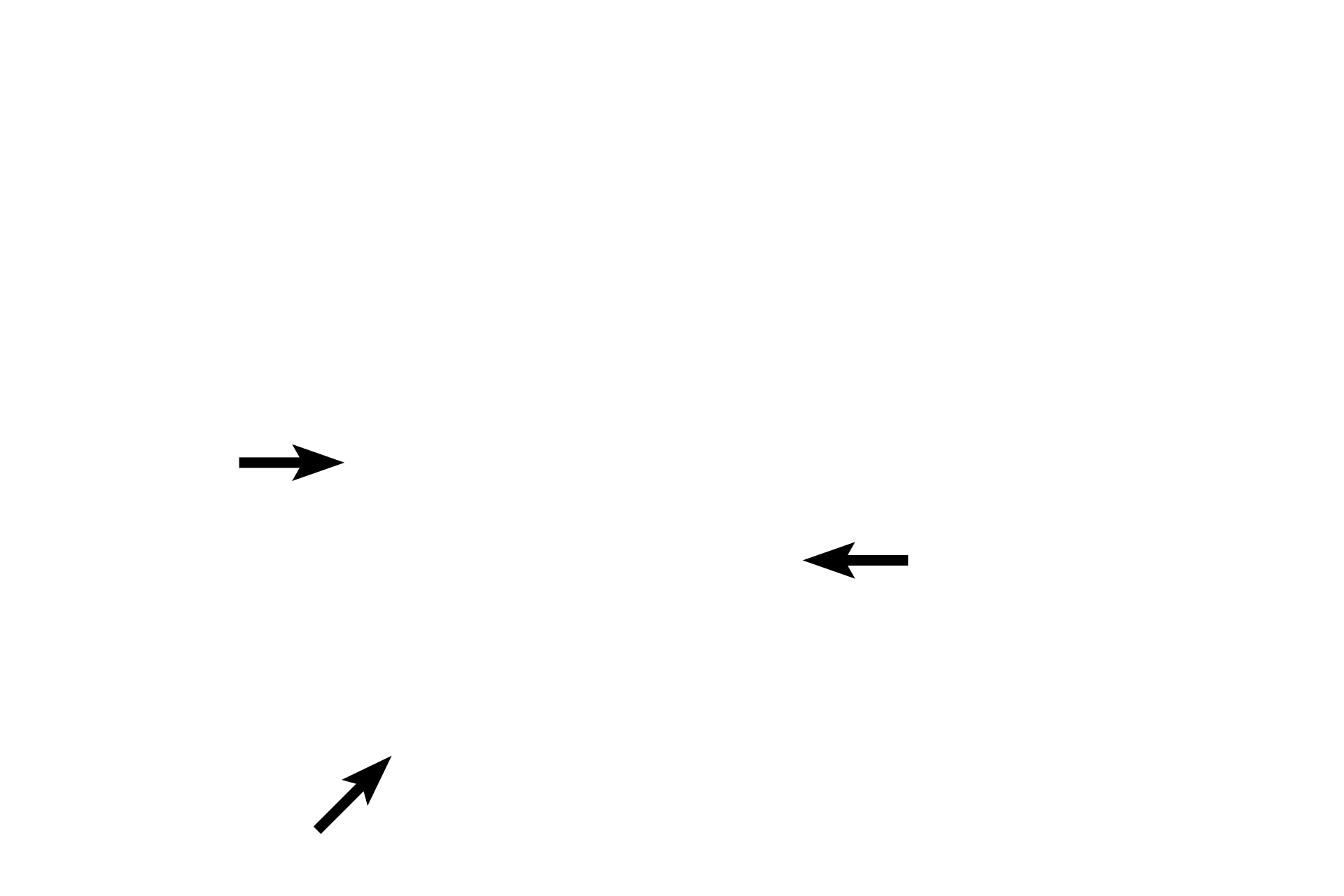  - Outer longitudinal layer <p>The muscularis externa, the third tunic, is usually composed of smooth muscle. Most frequently, this smooth muscle is arranged into an inner circular and an outer longitudinal layer. It is responsible for producing propulsive peristaltic waves of contraction as well as mixing of the luminal contents (segmentation).</p>
