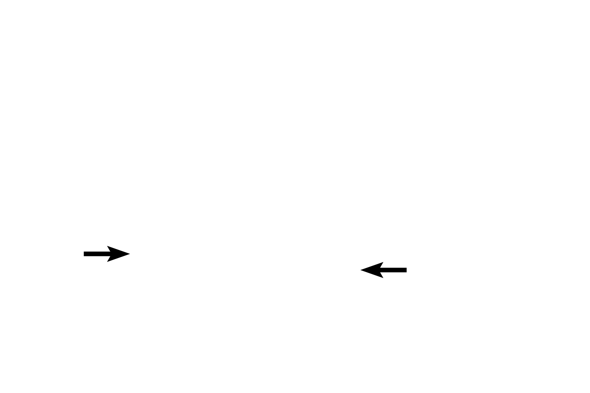 Outermost tunic:  Adventitia > <p>The outermost tunic is either an adventitia or a serosa. The adventitia is a layer of connective tissue that becomes continuous with the connective tissue of the posterior body wall where organs contact that surface.</p>
