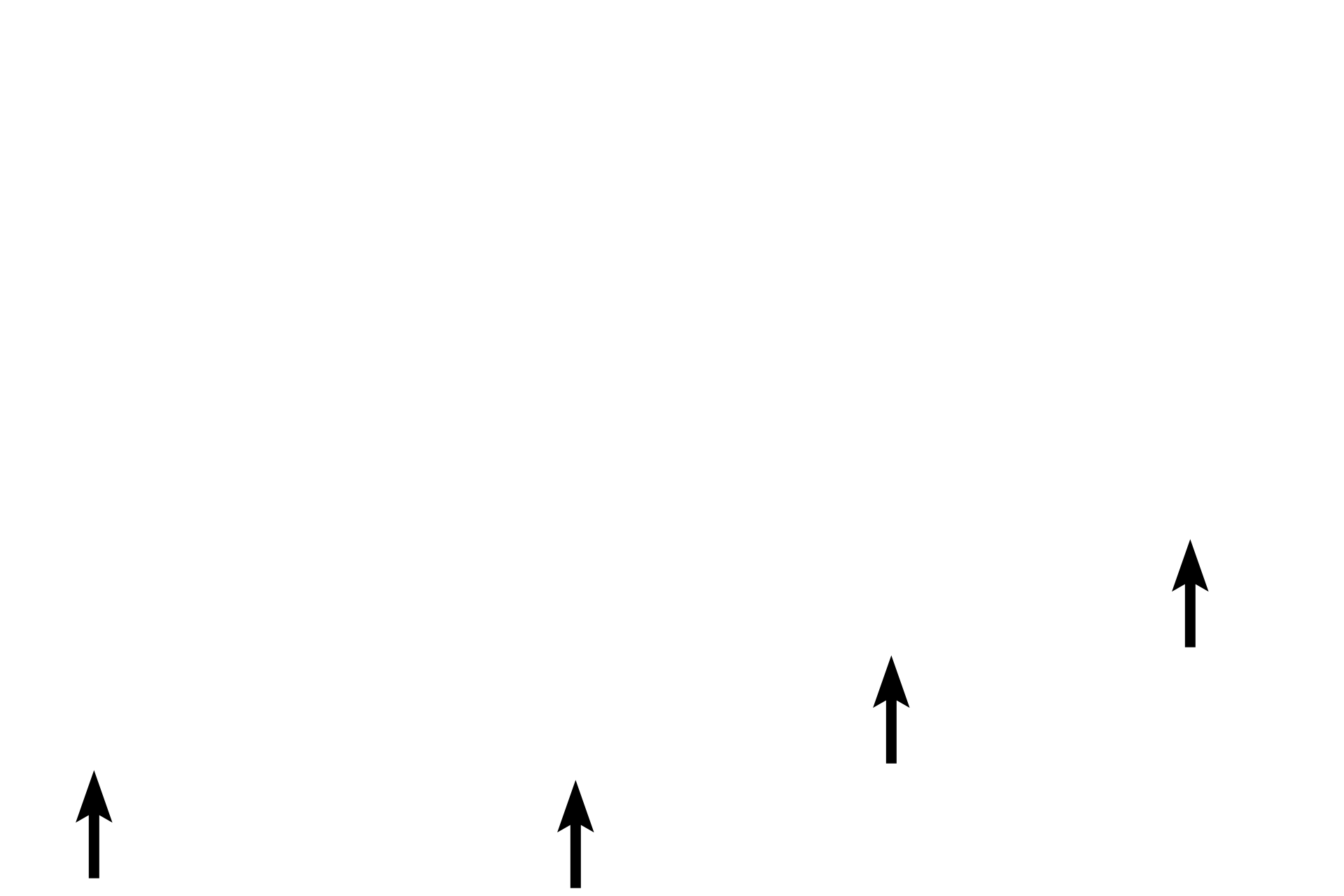 Serosa <p>The submucosa is composed of dense connective tissue.  The gastic muscularis externa is composed of three layers of smooth muscle instead of the usual two; however, the additional internal oblique layer is inconsistently present.  The stomach is covered on its exterior surface by a serosa because this organ protrudes into the peritoneal cavity.</p>

