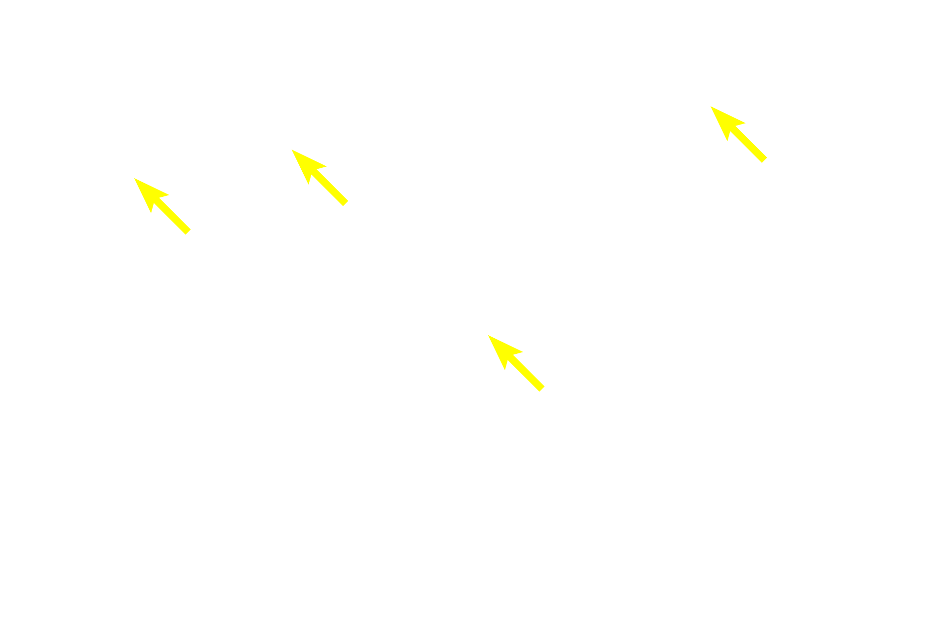 Mucin <p>The simple columnar epithelium lining the stomach is modified to form a sheet gland, with each cell in the sheet actively producing the mucus that protects the stomach from its acidic environment.  Mucin accumulates in the apex of each cell while the cytoplasm and nucleus are squeezed into the slender stem of the cell.  1000x</p>
