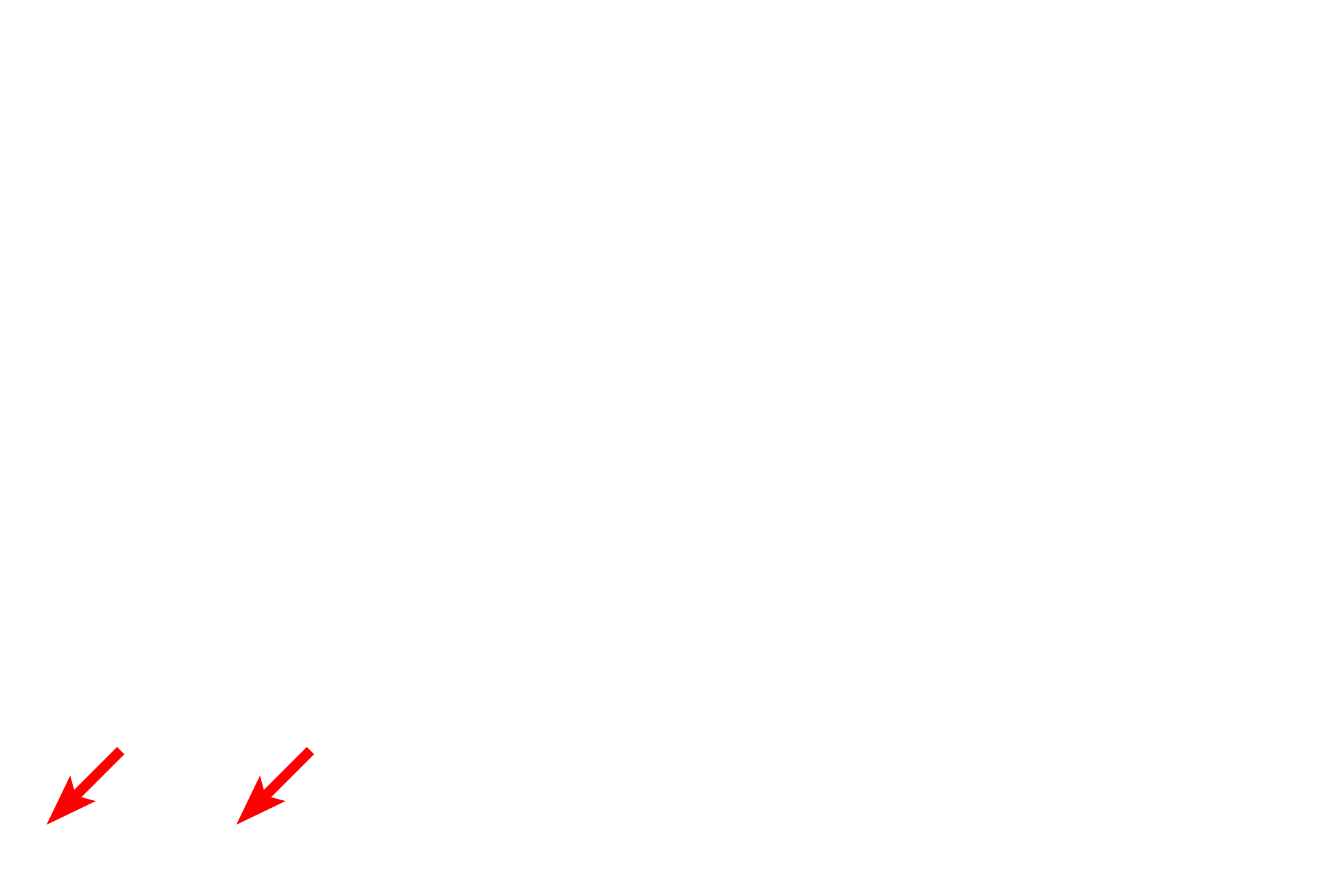 Serosa <p>The submucosa of the digestive system is composed of dense connective tissue, possessing an extensive meshwork of axons and ganglia called the submucosal (Meissner’s) plexus.  This plexus supplies autonomic innervation to muscularis mucosae and glands.  Ganglia in the plexus contain postganglionic parasympathetic nerve cell bodies.  Trichrome stain, 100x, 800x</p>
