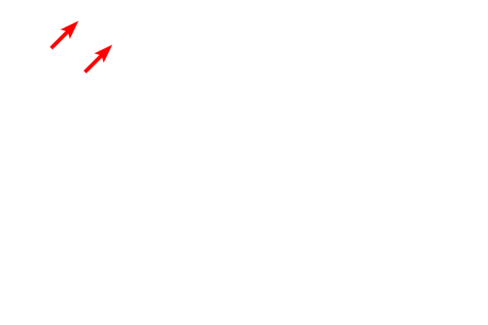  - Gastric pits <p>The submucosa of the digestive system is composed of dense connective tissue, possessing an extensive meshwork of axons and ganglia called the submucosal (Meissner’s) plexus.  This plexus supplies autonomic innervation to muscularis mucosae and glands.  Ganglia in the plexus contain postganglionic parasympathetic nerve cell bodies.  Trichrome stain, 100x, 800x</p>
