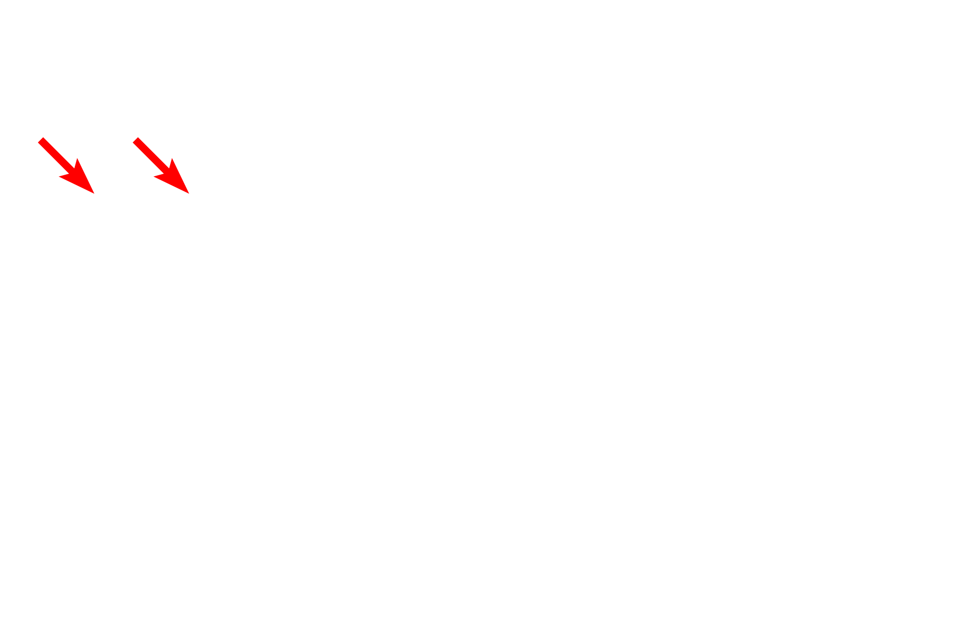  - Pyloric glands <p>The submucosa of the digestive system is composed of dense connective tissue, possessing an extensive meshwork of axons and ganglia called the submucosal (Meissner’s) plexus.  This plexus supplies autonomic innervation to muscularis mucosae and glands.  Ganglia in the plexus contain postganglionic parasympathetic nerve cell bodies.  Trichrome stain, 100x, 800x</p>
