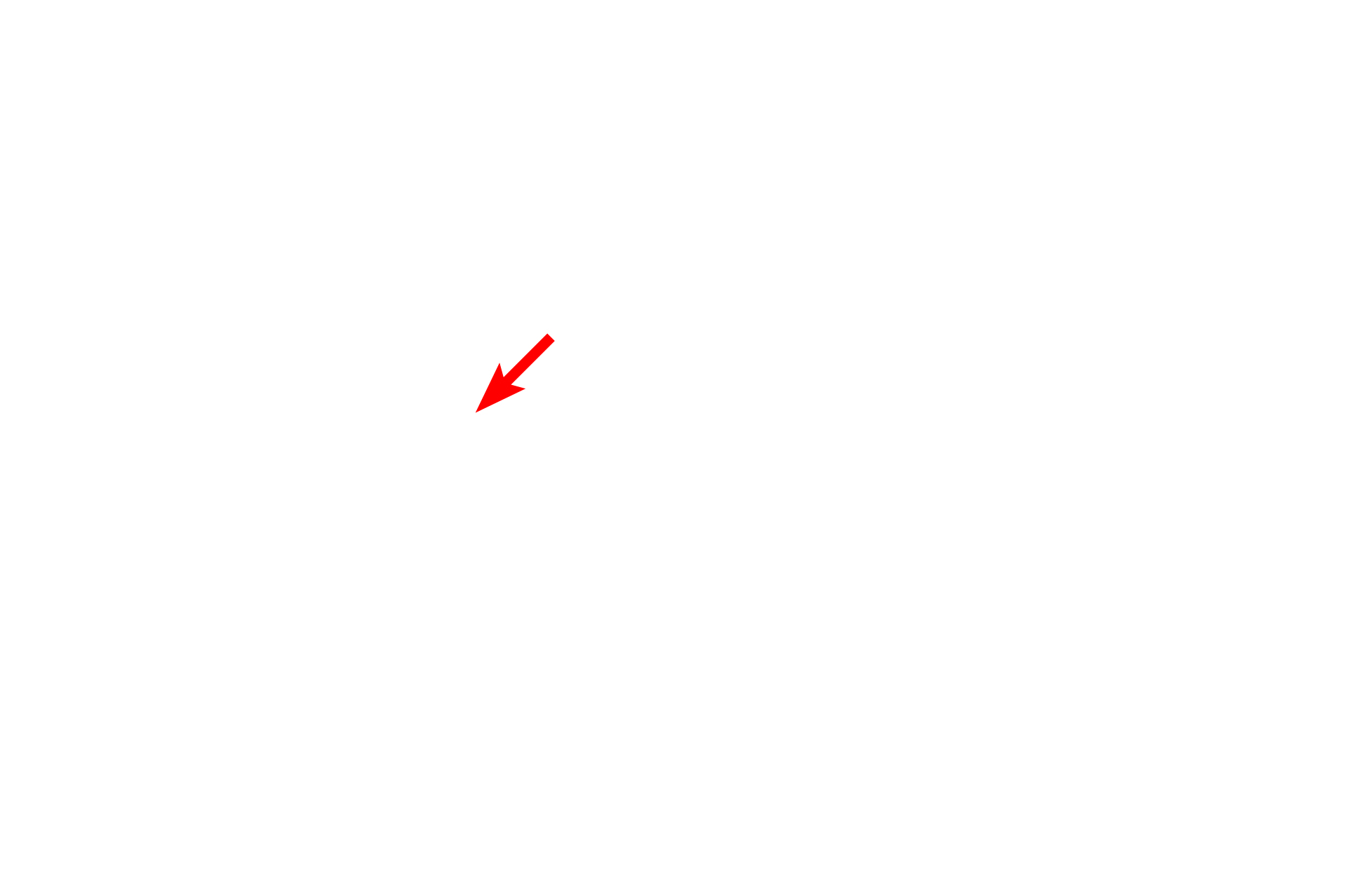  - Peripheral nerve <p>The submucosa of the digestive system is composed of dense connective tissue, possessing an extensive meshwork of axons and ganglia called the submucosal (Meissner’s) plexus.  This plexus supplies autonomic innervation to muscularis mucosae and glands.  Ganglia in the plexus contain postganglionic parasympathetic nerve cell bodies.  Trichrome stain, 100x, 800x</p>

