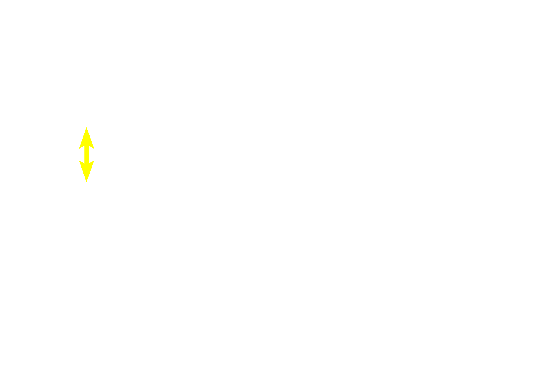 Submucosa <p>Muscularis externa of the stomach has inner oblique (an inconsistent layer), middle circular, and outer longitudinal layers; only the latter two layers are seen here.  The myenteric (Auerbach’s) plexus, located between circular and longitudinal muscle layers, provides fibers from the autonomic nervous system to muscularis externa.  A serosa is the outermost tunic.  Trichrome stain, 100x, 800x</p>
