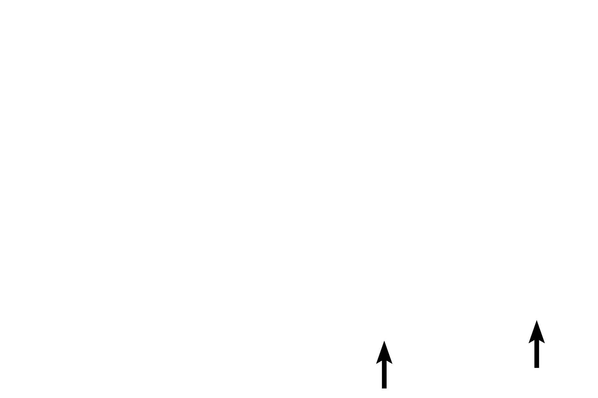  - Mesothelium <p>Muscularis externa of the stomach has inner oblique (an inconsistent layer), middle circular, and outer longitudinal layers; only the latter two layers are seen here.  The myenteric (Auerbach’s) plexus, located between circular and longitudinal muscle layers, provides fibers from the autonomic nervous system to muscularis externa.  A serosa is the outermost tunic.  Trichrome stain, 100x, 800x</p>
