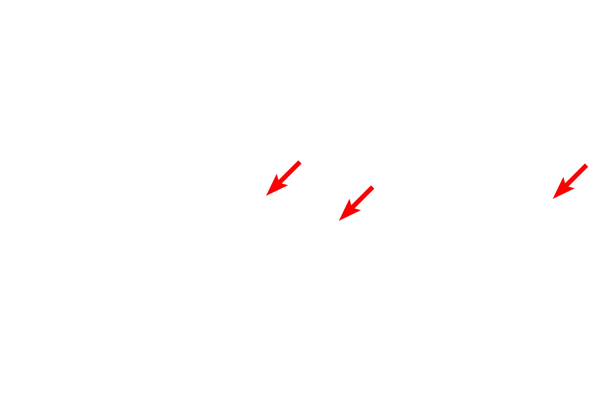  - Peripheral nerves <p>The myenteric (Auerbach’s) plexus lies between the layers of the muscularis externa throughout the tubular digestive system, providing autonomic innervation to the smooth muscle of muscularis externa.  The plexus is a network of unmyelinated axons and ganglia, whose large neuronal cell bodies give rise to the postganglionic parasympathetic fibers in the plexus.  Trichrome stain, 1000x</p>
