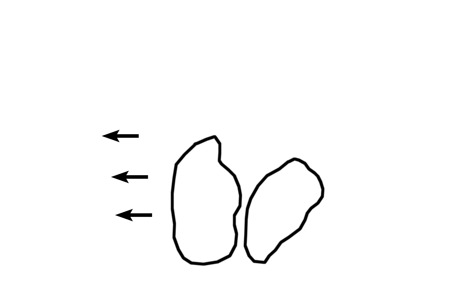 Cardiac glands <p>A sharp transition in the epithelium, from stratified squamous moist (esophagus) to simple columnar (stomach), marks the transition of these two organs.  The depth of the gastric pits (foveolae) is about equal to the length of the glands in the cardiac region (a diagnostic feature for the cardiac region of the stomach).  100x</p>
